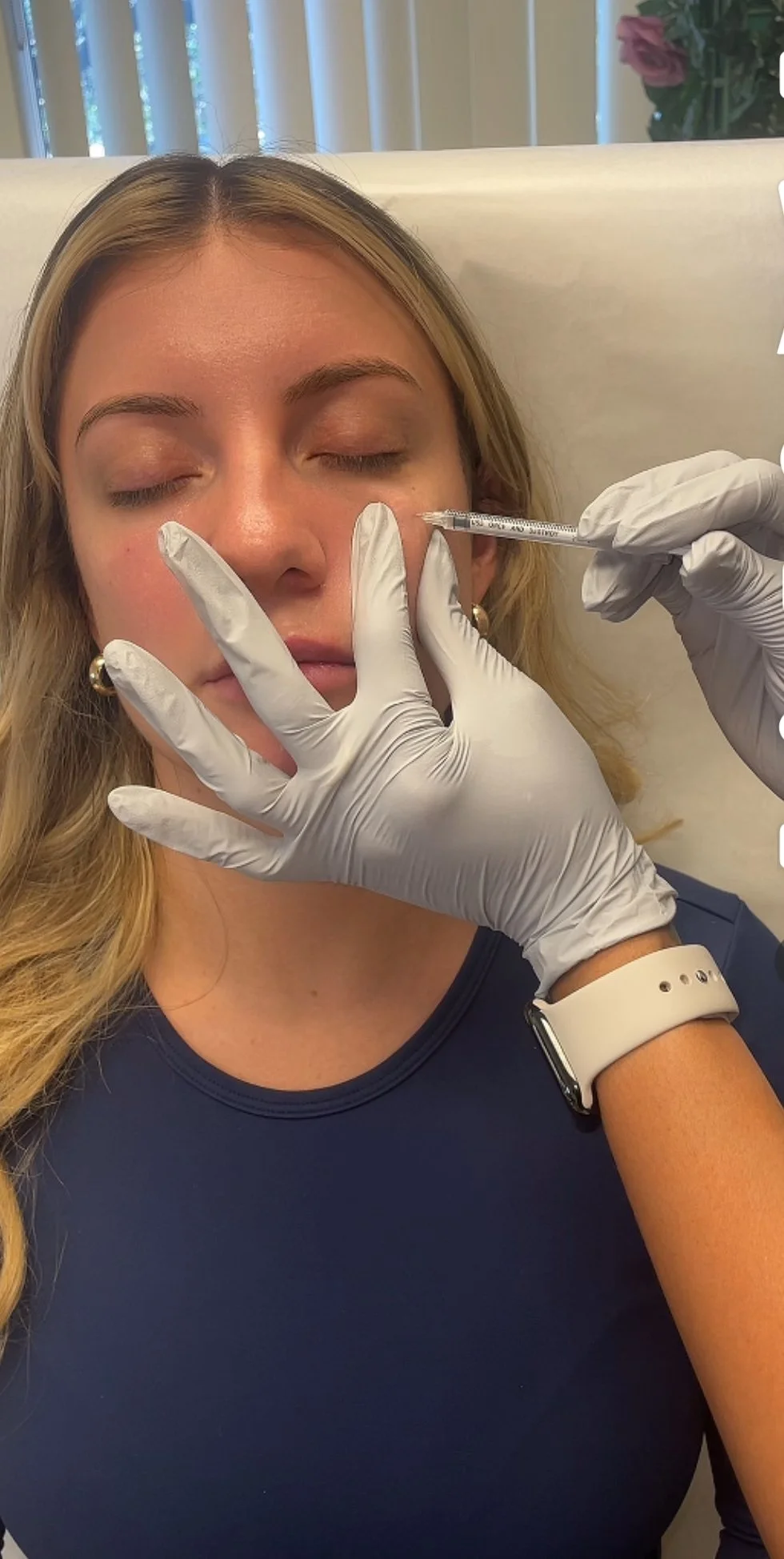 Botox Consultation