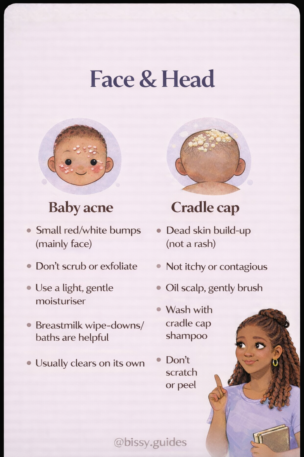 Baby acne and cradle cap on face and scalp showing white bumps and flaky patches on newborn skin