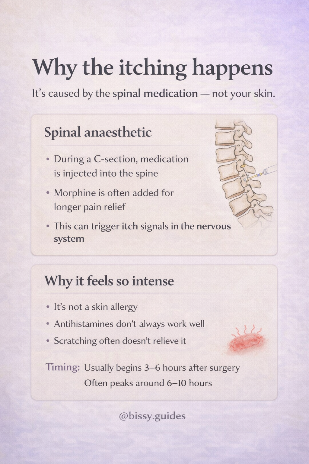 Educational illustration explaining how spinal anaesthetic medication can cause itching after a Caesarean birth.