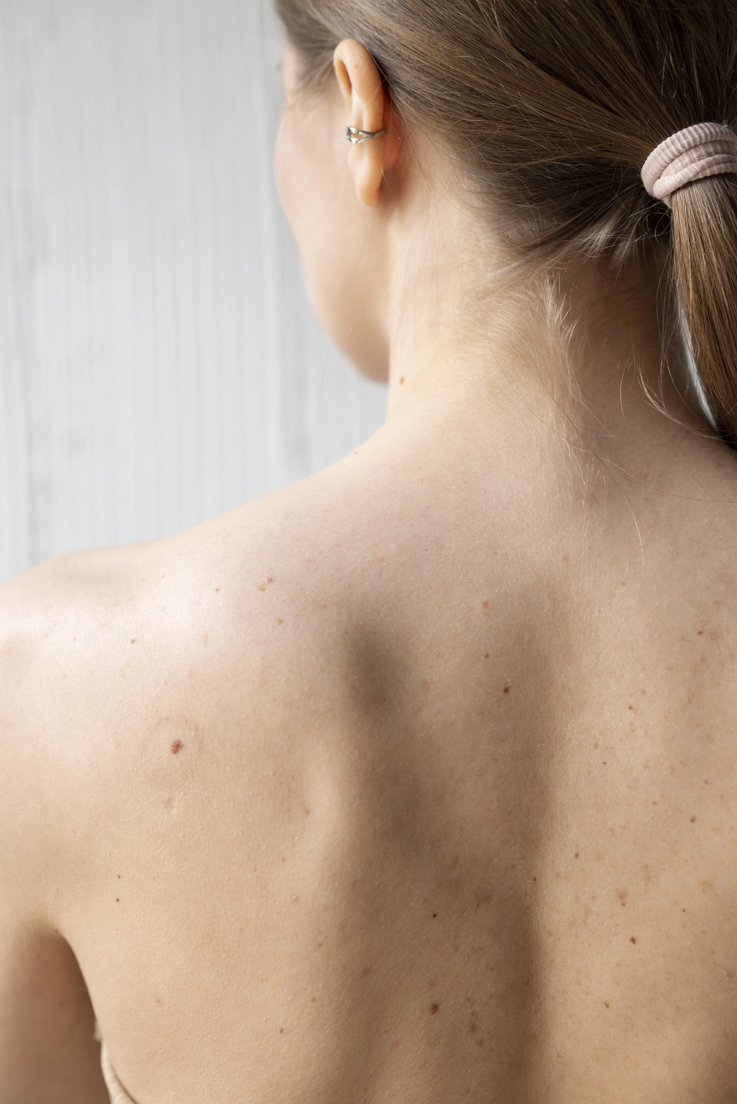 Mole and Skin Tag Removal