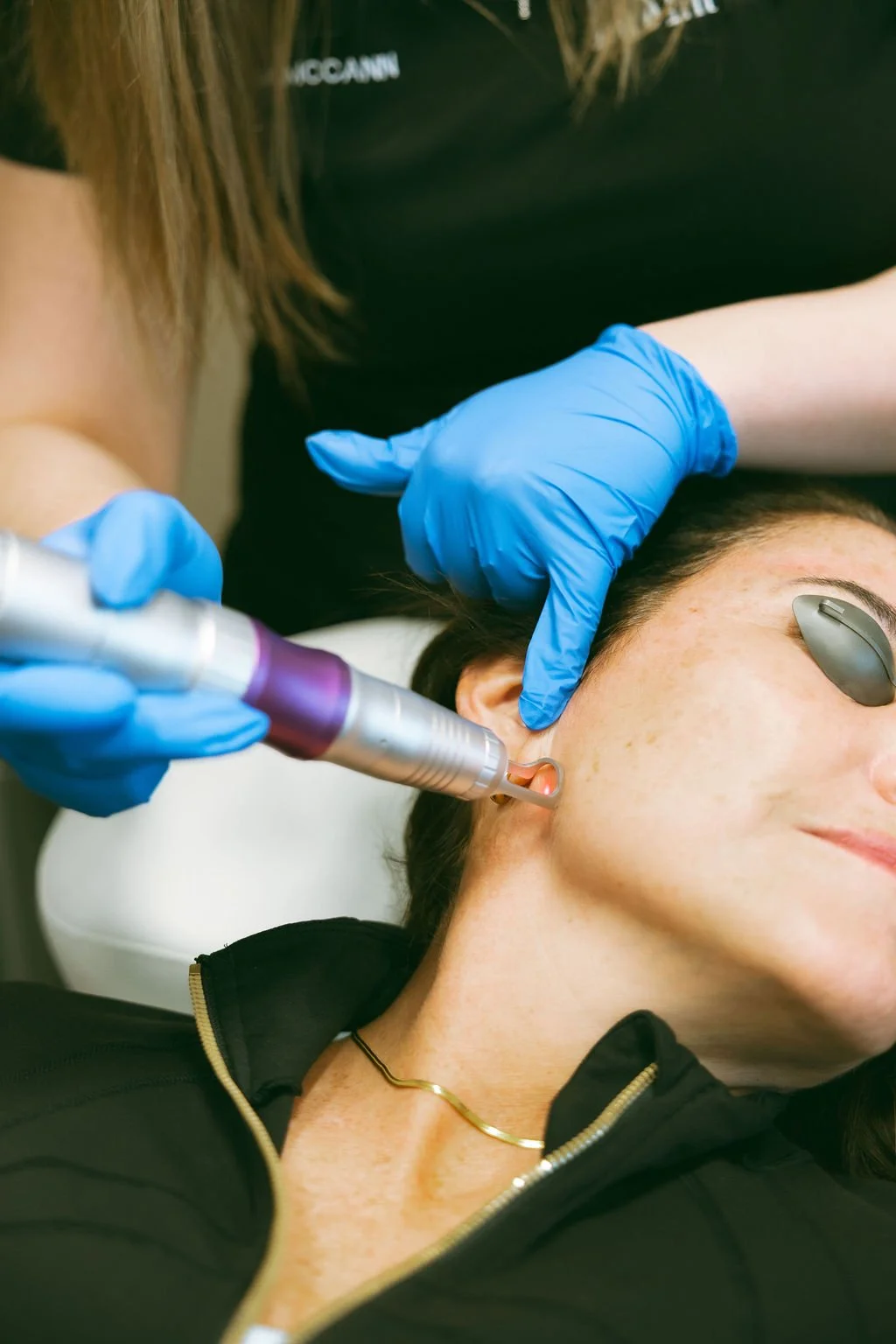A person receiving a cosmetic or dermatological treatment near the ear, with a healthcare professional using a handheld device and wearing blue gloves.