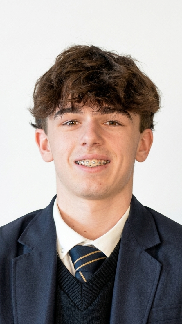 Young man in school uniform with braces, wearing a navy blazer, white shirt, and striped tie, smiling against a plain white background.