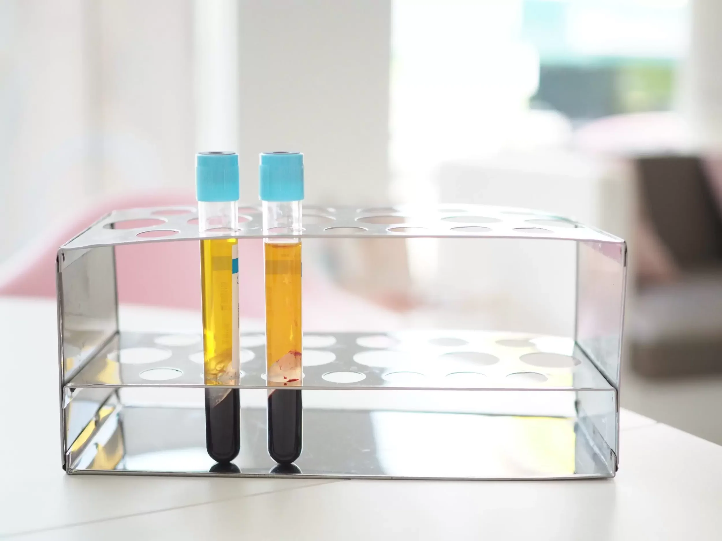 Test tubes with yellow liquid and blue caps in a metal rack.