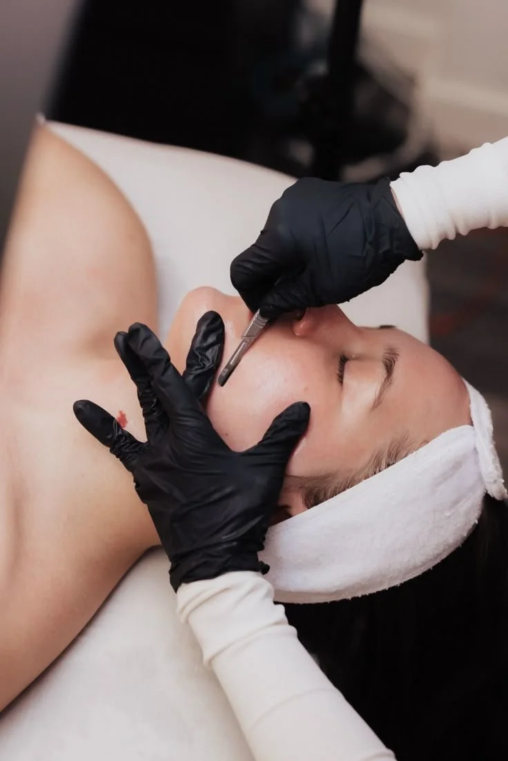 A person is getting a cosmetic or medical procedure on their face, with a professional wearing black gloves injecting or applying treatment near the person's cheek.