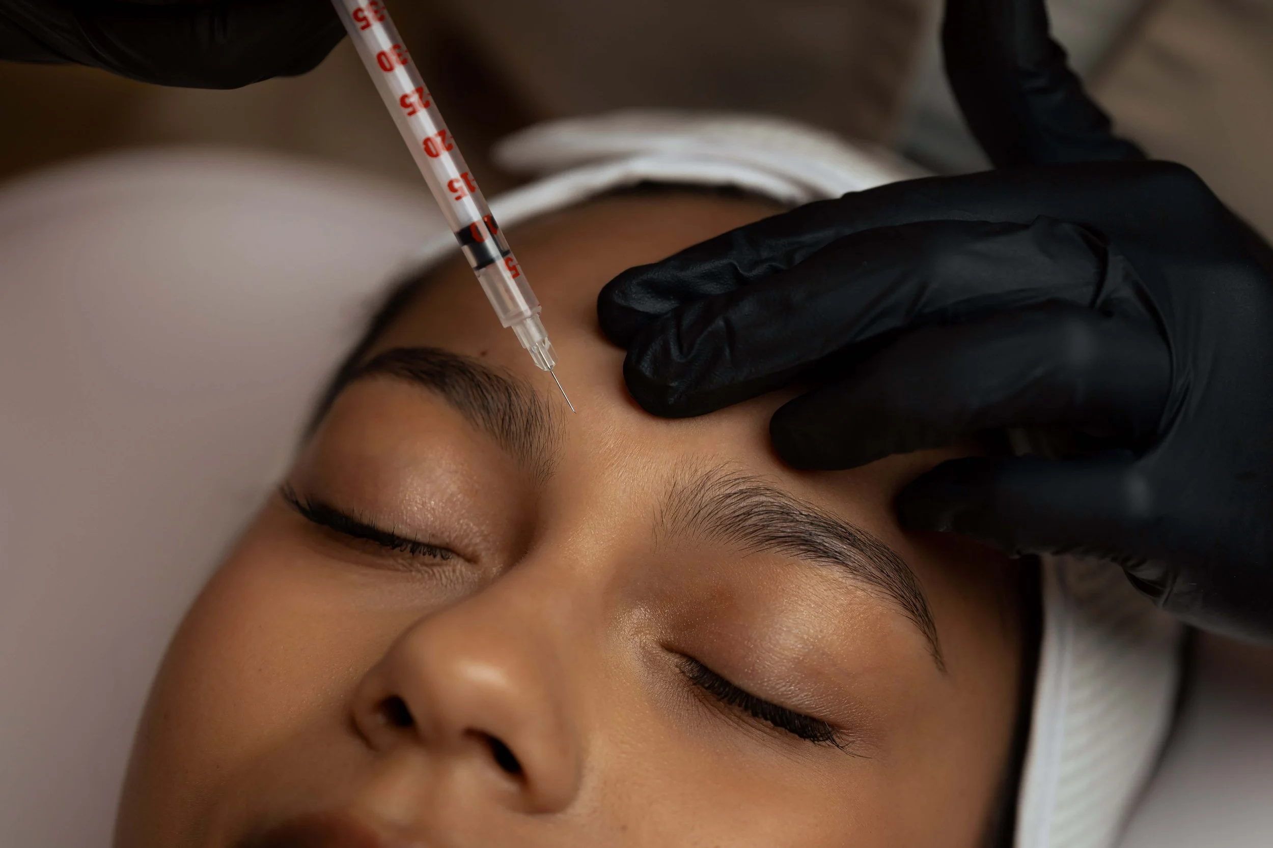 Close-up of a person receiving a cosmetic injection in the forehead area with a syringe held by a gloved hand.