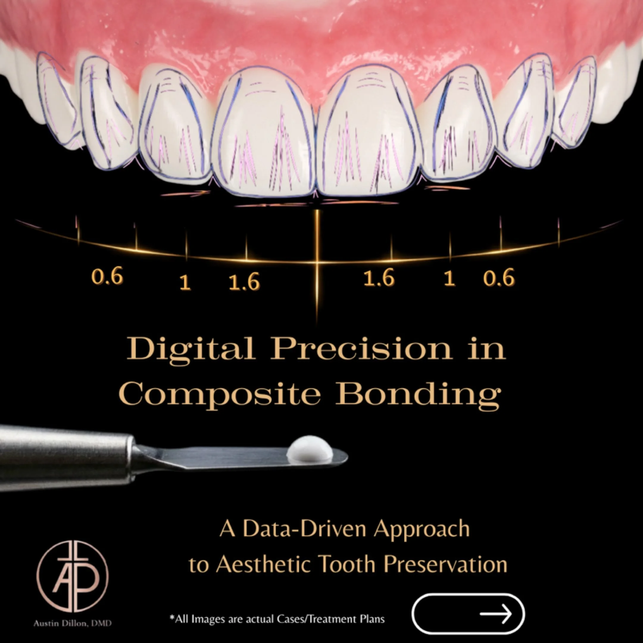 There is something truly remarkable about taking an idea, blending it with technology, and transforming that vision into something tangible for another person.
 In dentistry, we have the unique opportunity to combine artistry, science, and innovation