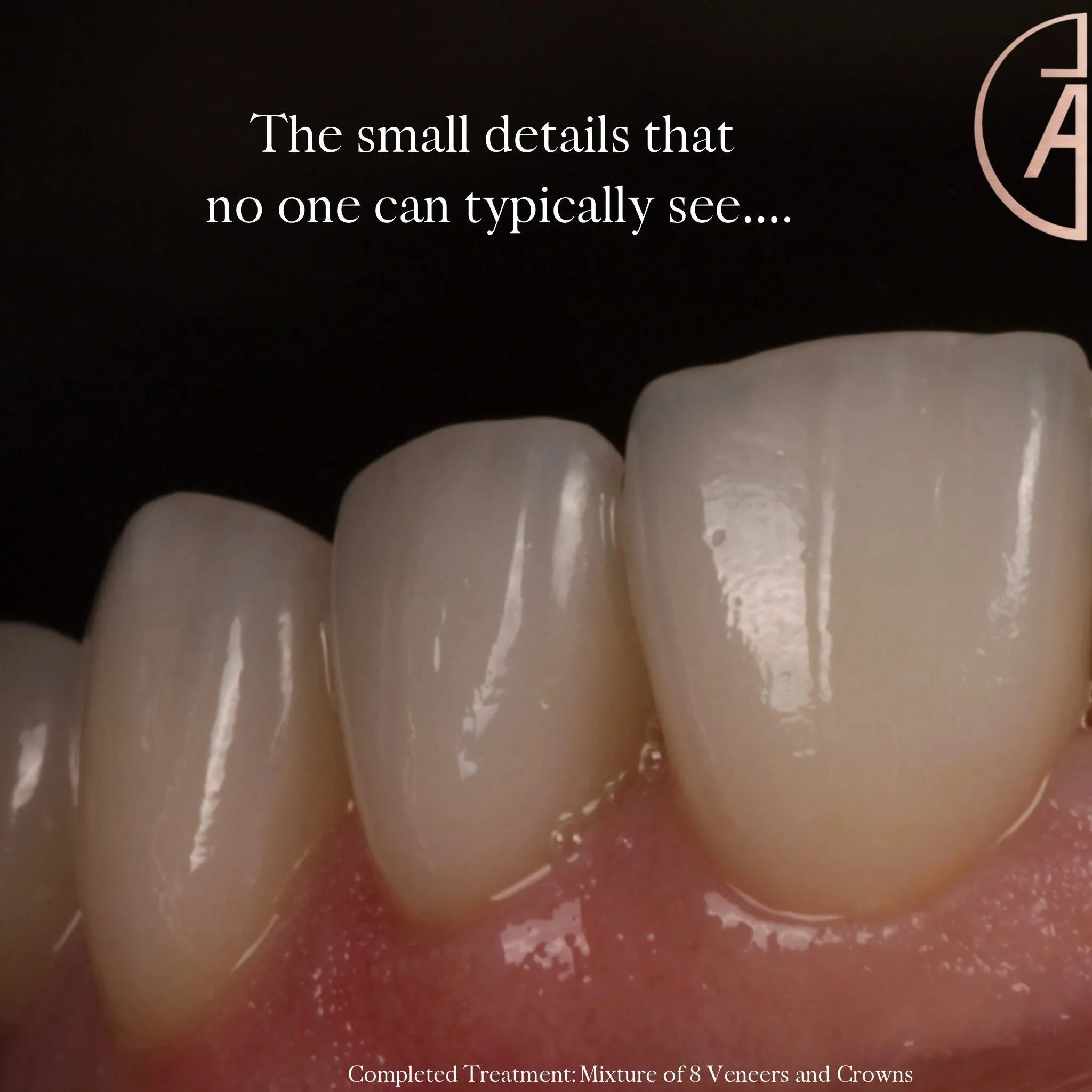 Patients may never see every detail we obsess over.
But they deserve the care that goes into every single one.

As dentists, we hold ourselves to a standard that goes beyond what the patient can see with the naked eye. 
The goal isn&rsquo;t simply to