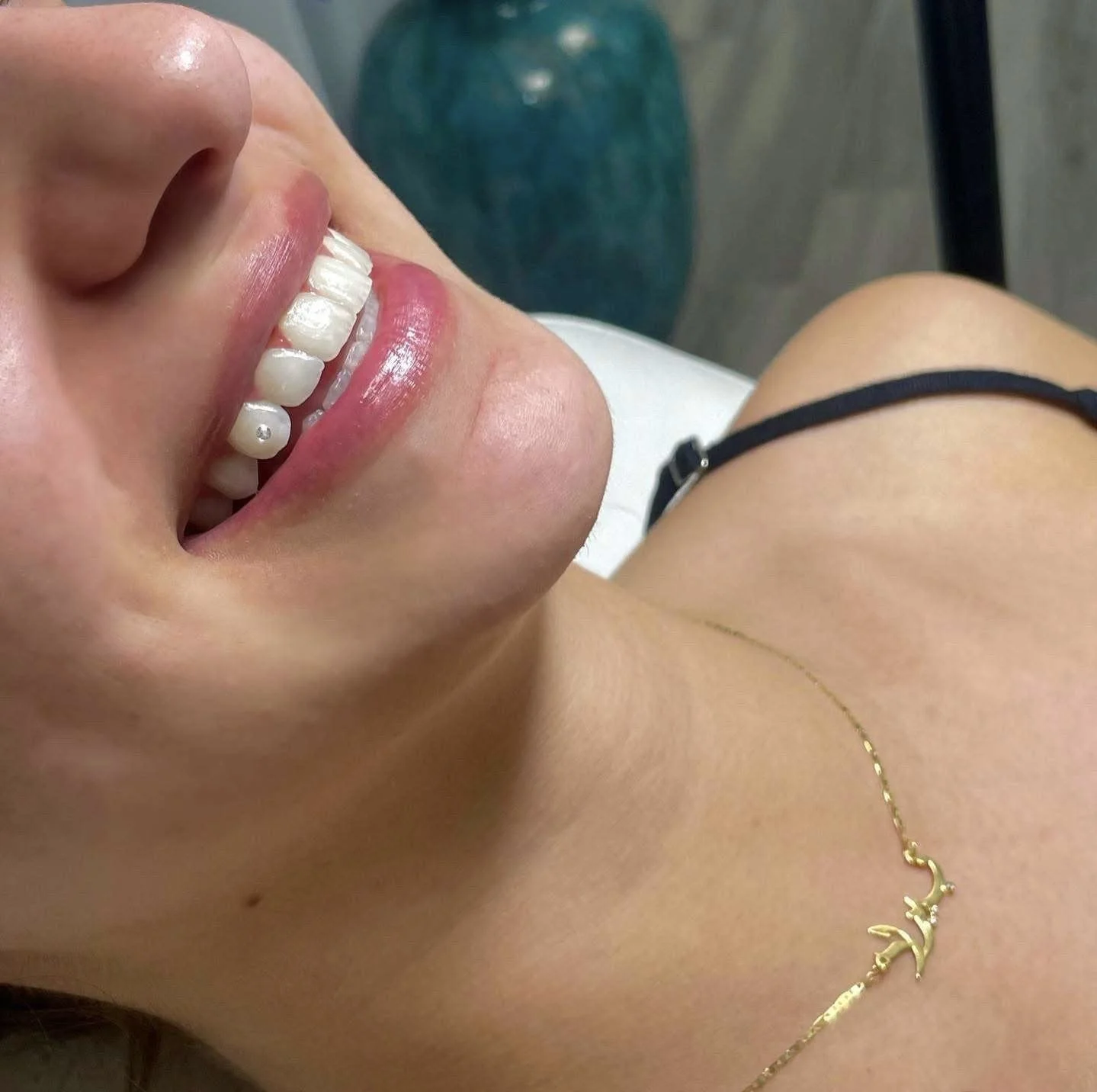 Close-up of a smiling woman with white teeth, pink lips, gold necklace, black strap, and skin visible, with a blurred background.