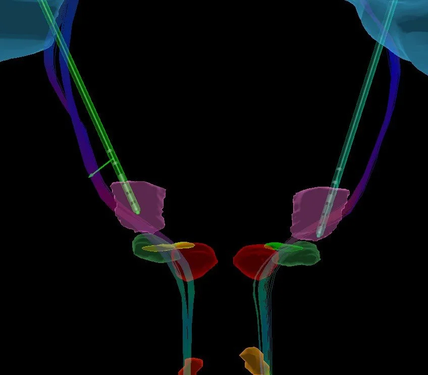 A 3D digital rendering of a human pelvis and urinary system, highlighting bones and organs.