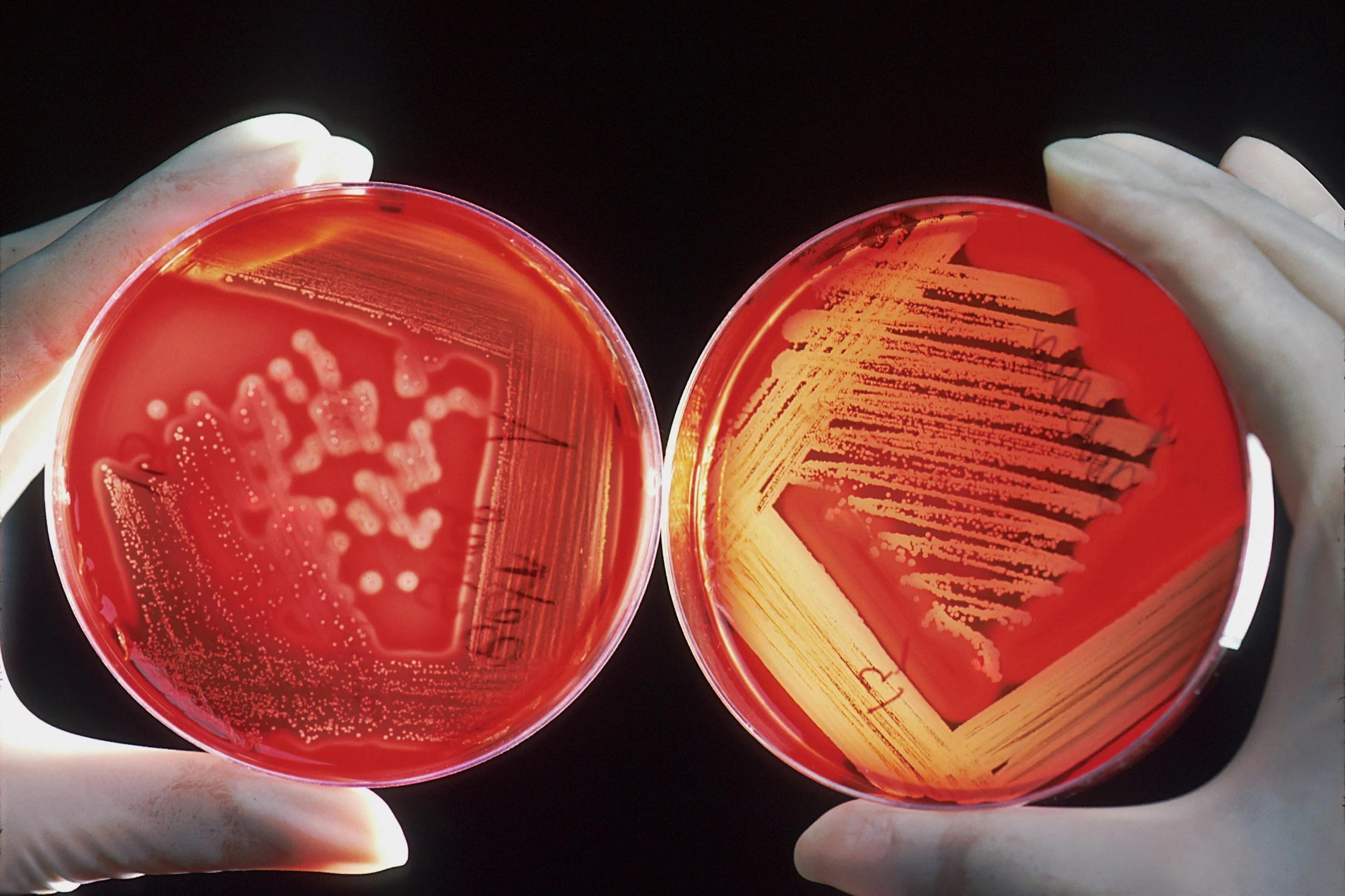 Image of two colonized petri dishes held against a black background.