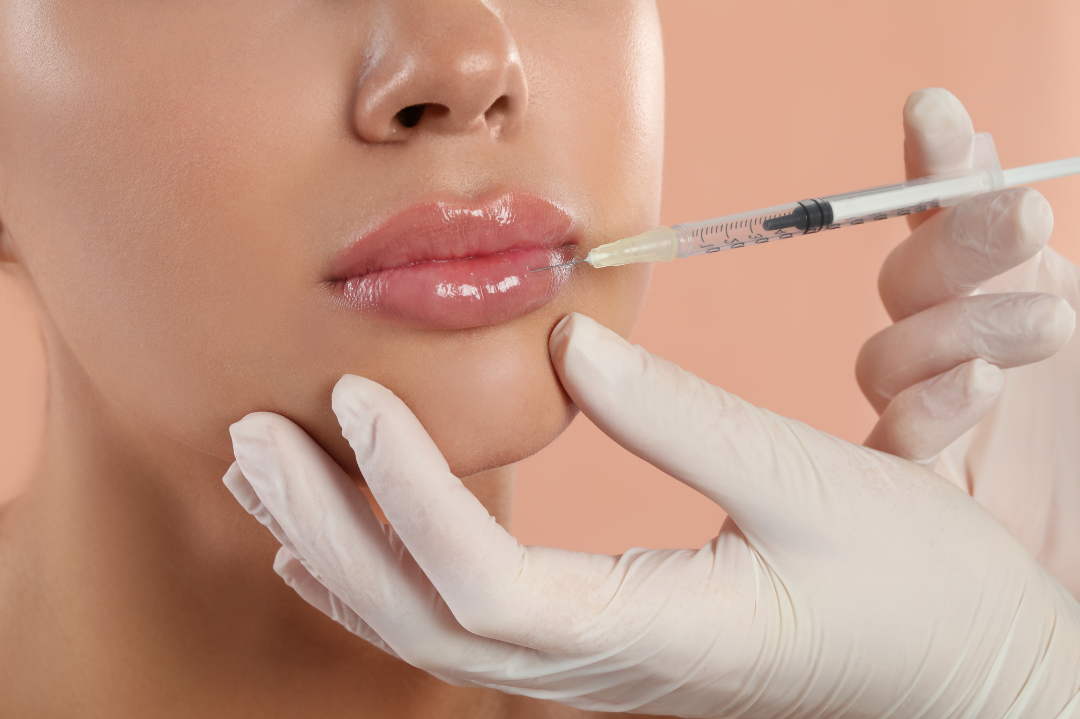 Dermal Fillers in Carlsbad, CA 92011 | Created Beautiful Aesthetics