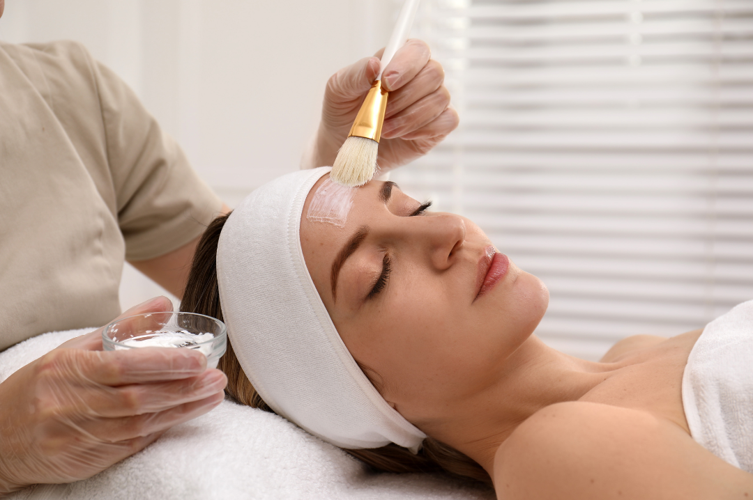 Chemical Peels in Carlsbad, CA 92011 | Created Beautiful Aesthetics