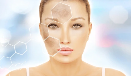 Chemical Peels in Carlsbad, CA 92011 | Created Beautiful Aesthetics