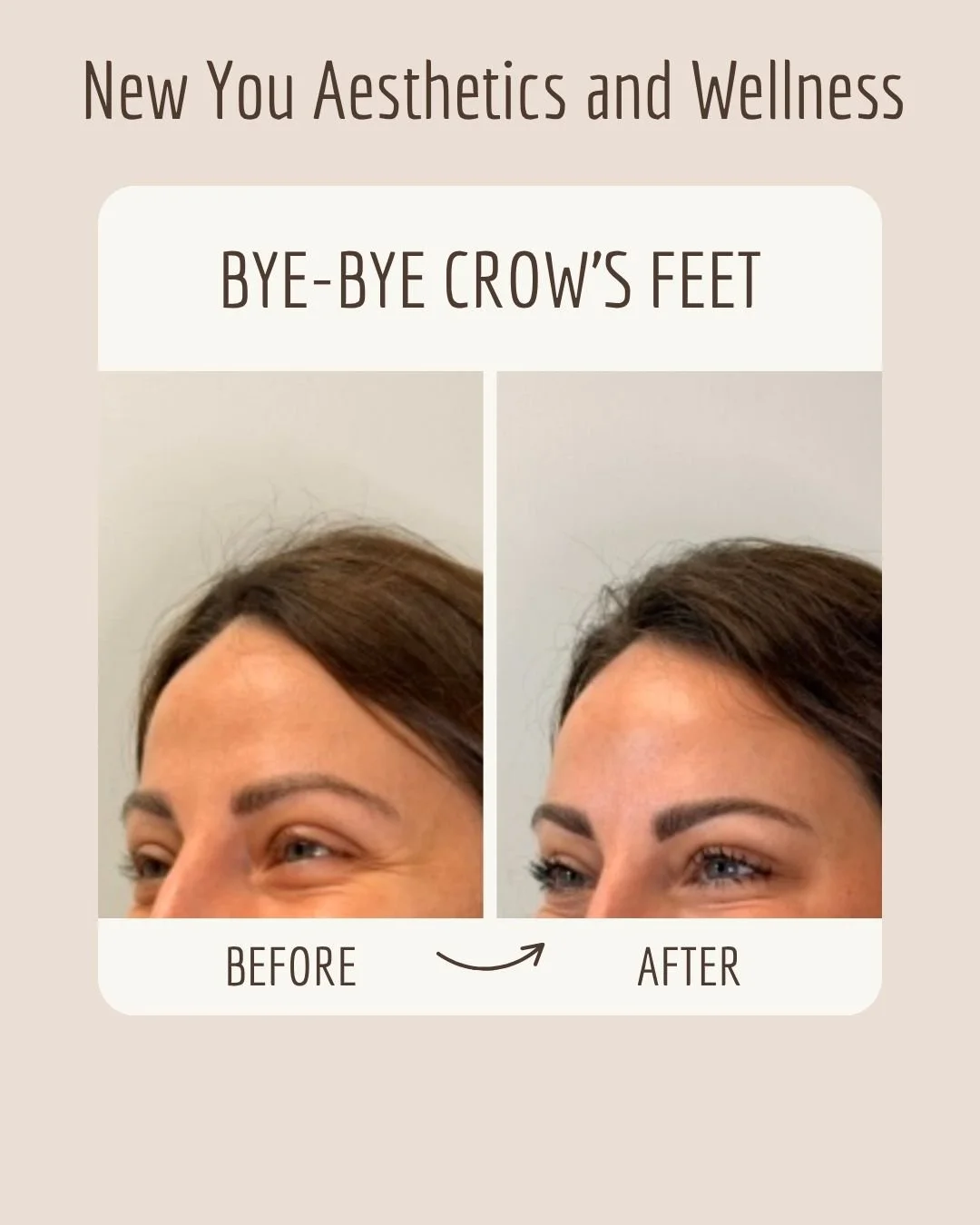 Crow left before and after - Paula Severns.jpg