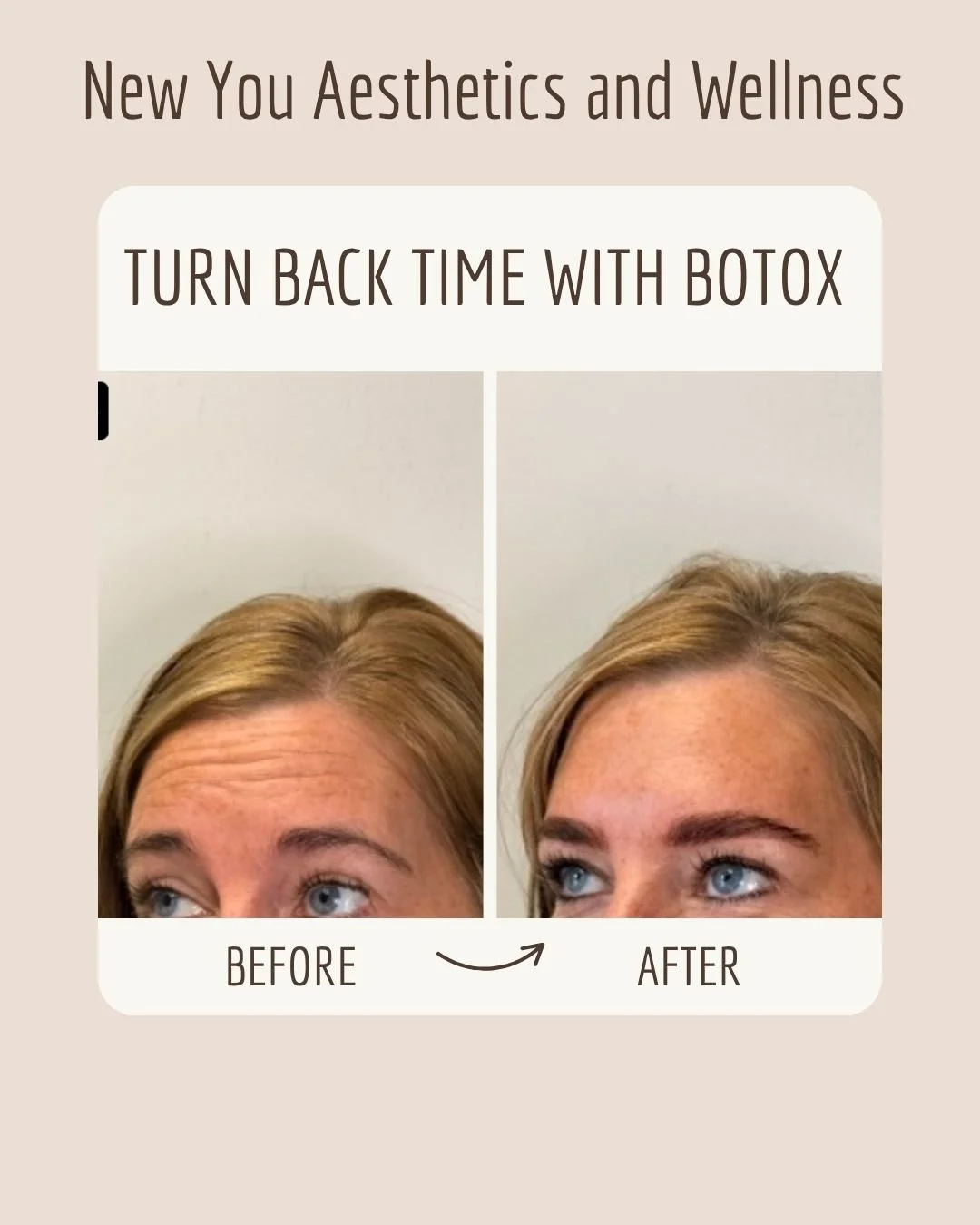 rest before and after - Paula Severns.jpg