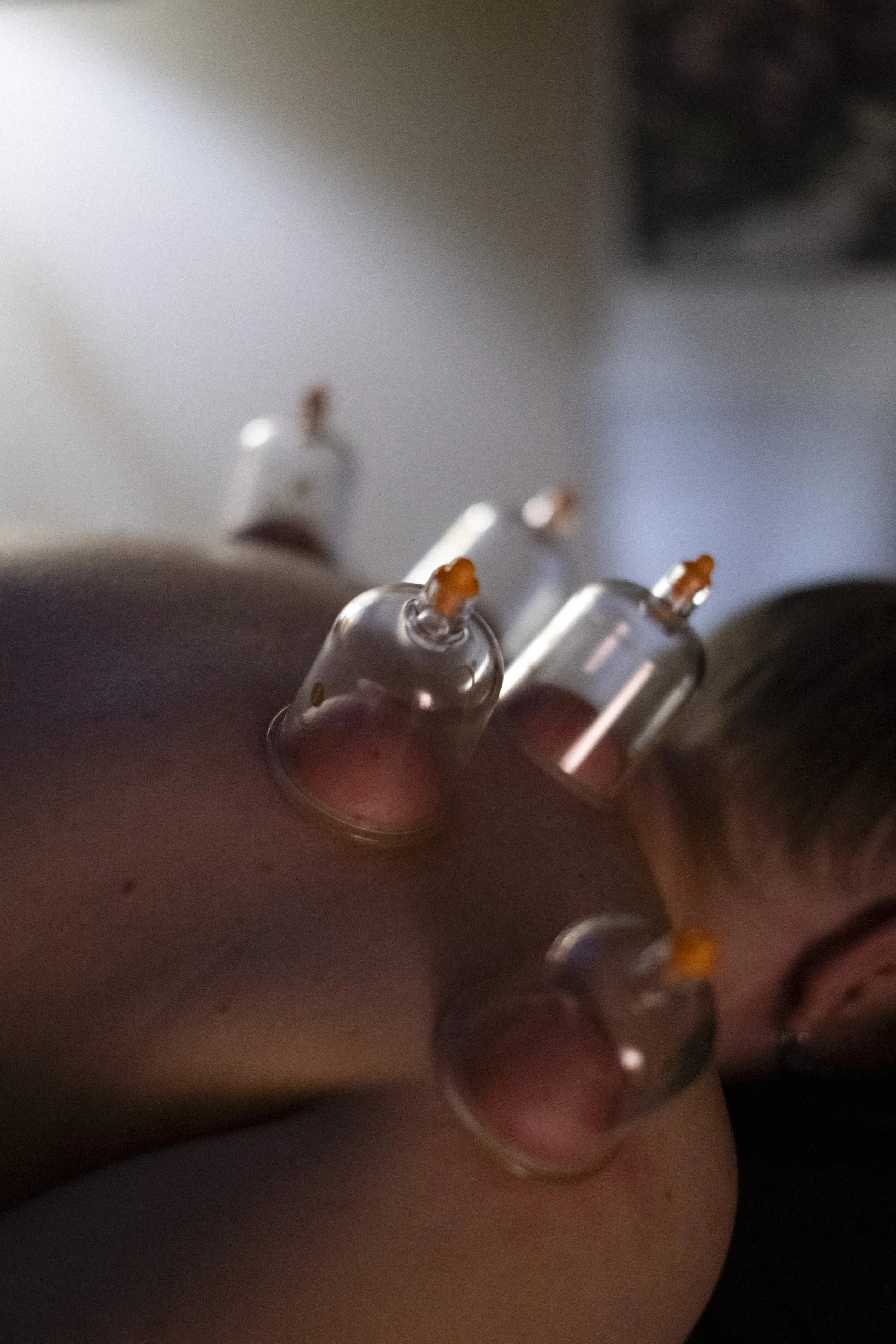 Cupping therapy applied to the upper back during a massage session, supporting circulation and release.