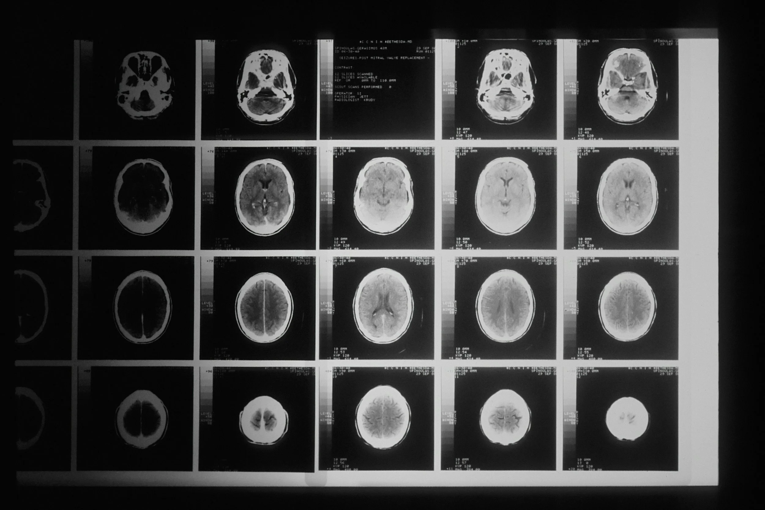 William is going for his MRI today at 11 AM.