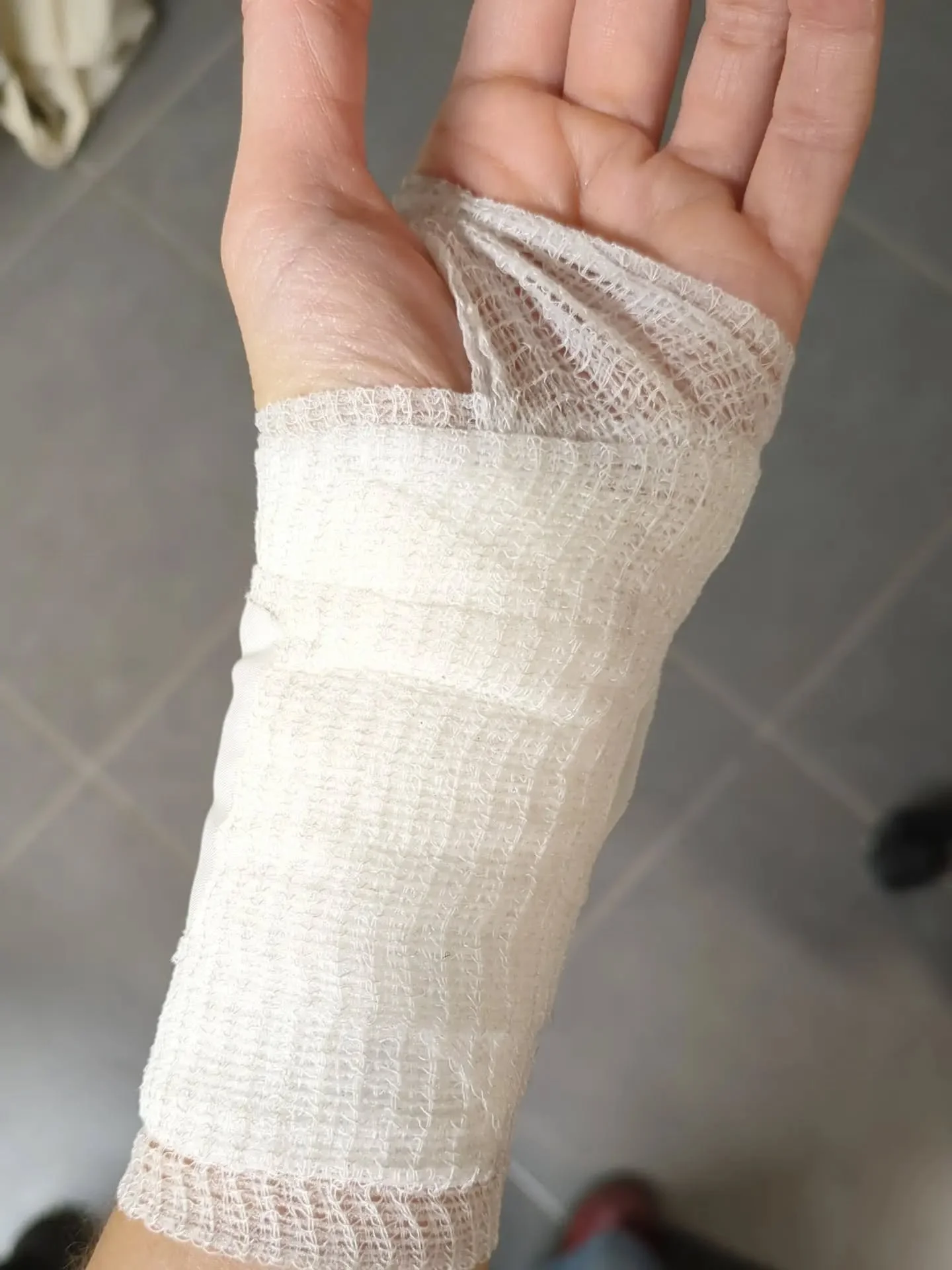 &bull; A Reminder: Rushing Is Never Worth It &bull;

Time for a little honest and open sharing.

During a lesson, I got cocky. In an attempt to speed up a process, I convinced myself that scalpel safety rules didn't  apply to me. The scalpel slipped,