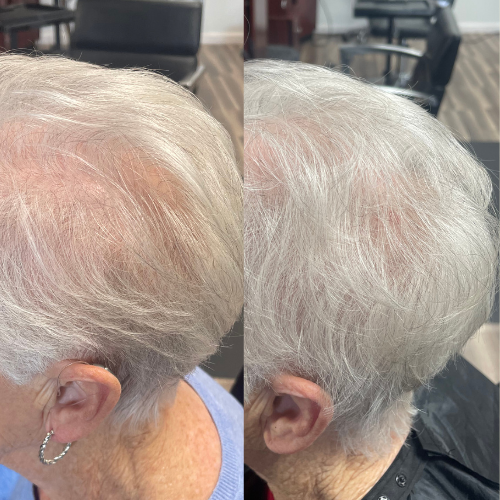 hair-growth-kapyderm.png