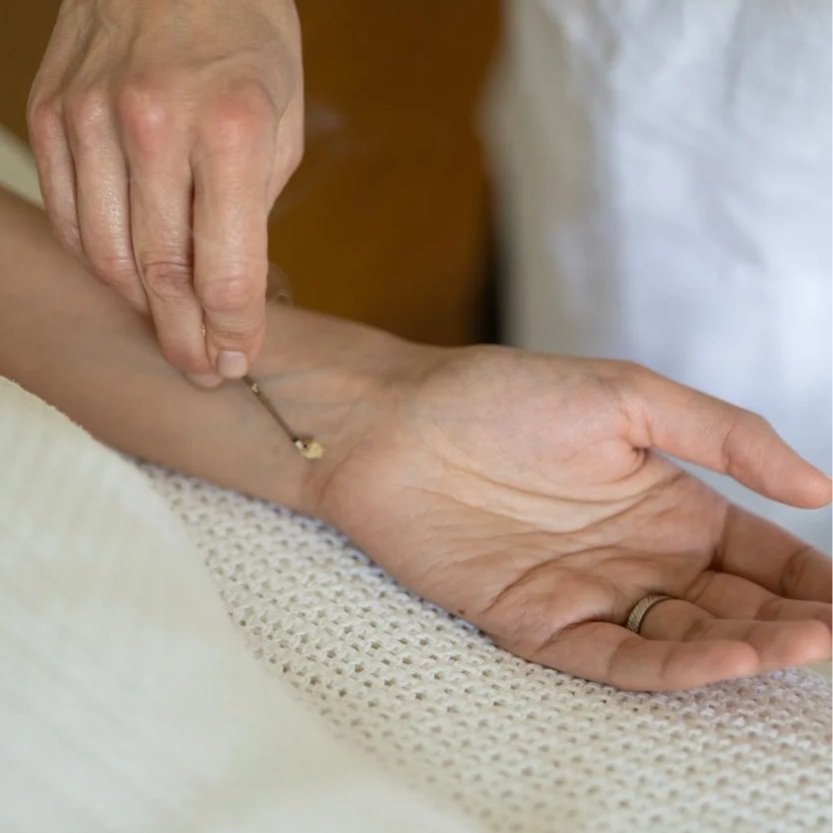 Acupuncture Point Names: Using Poetry to Touch the Soul