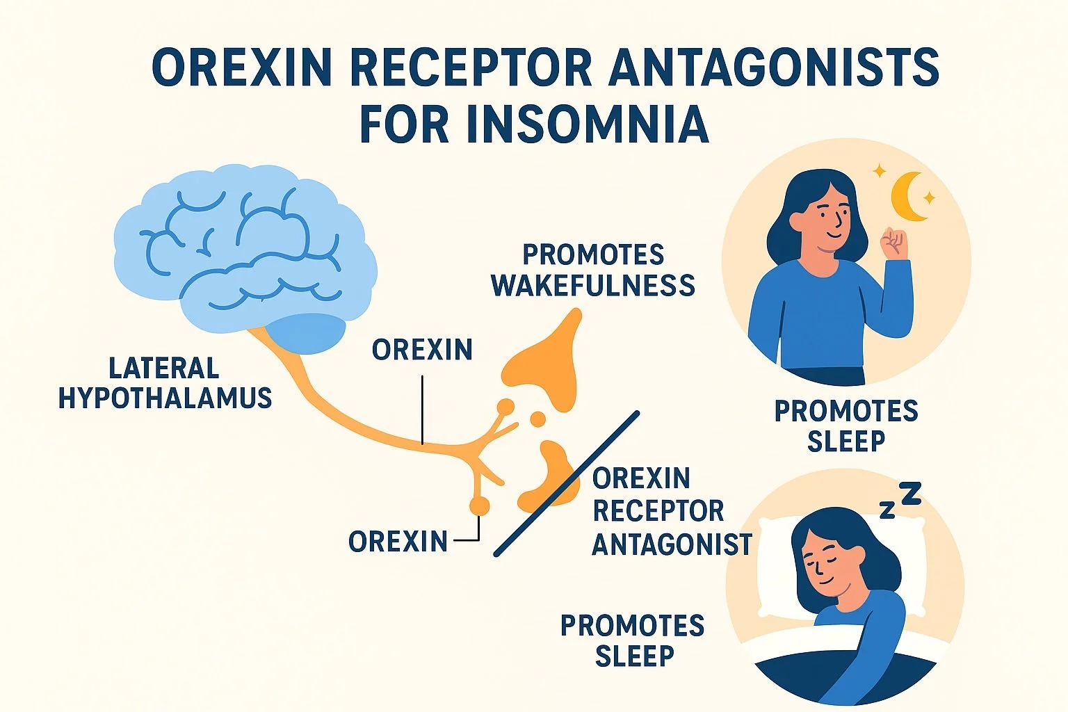 The New Generation of Sleep Medications: What to Know About Orexin Receptor Antagonists