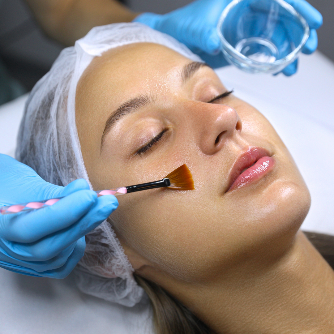 Medspa in Davenport, FL 33897 l Chemical Peels Near Me