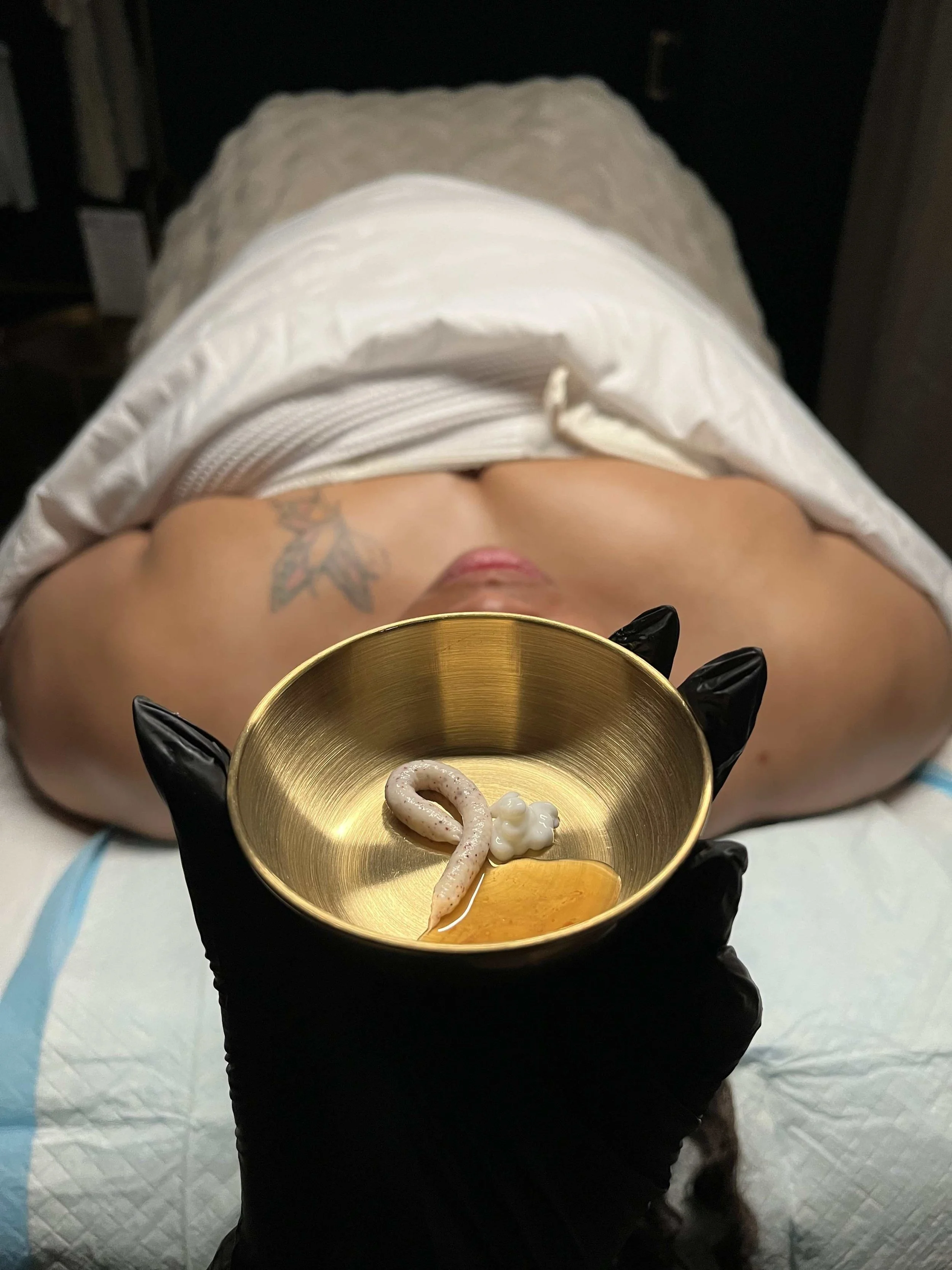 A person wearing black gloves holding a small gold bowl with a cream-colored, coiled object inside, and a dollop of white substance. The person is shirtless, with a floral tattoo on their chest, and appears to be lying on a medical table.