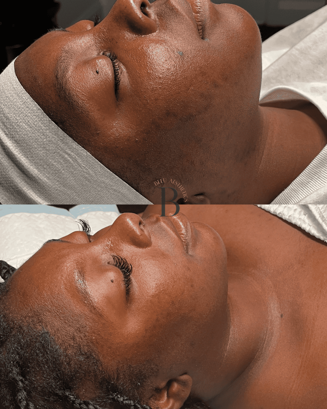 Close-up of two women lying down with eyes closed, receiving skincare or facial treatments, one wearing a white headband.
