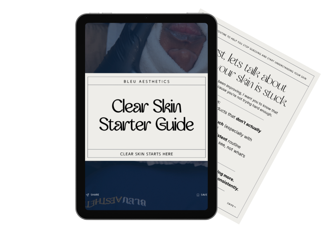 A tablet displaying the cover of a skincare guide titled 'Clear Skin Starter Guide' by BLEU AESTHETICS, with a background that appears to be a person with clear skin. There are also printed pages behind the tablet with skin care tips.
