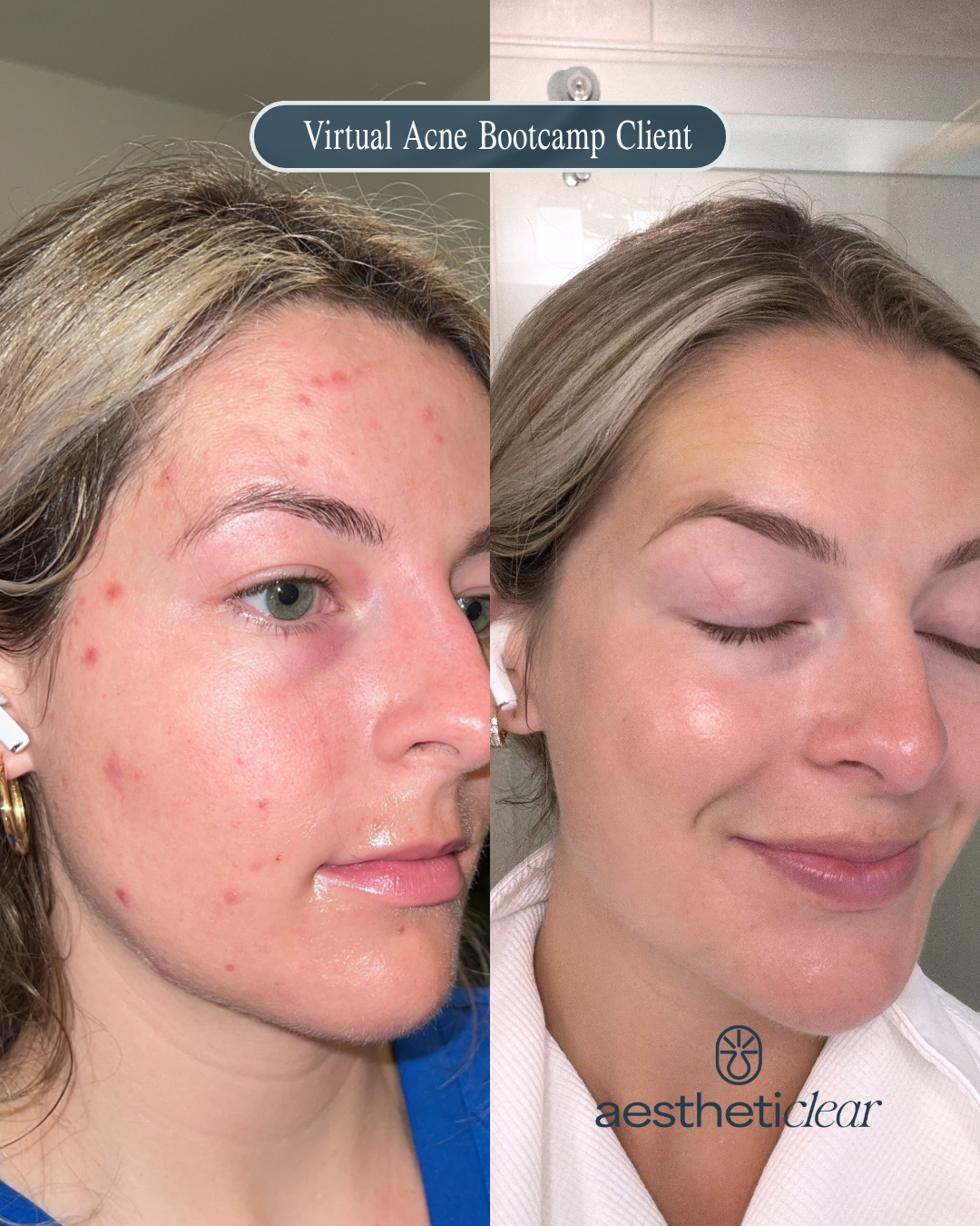 Copy of Before and afters Vertial - 1.png