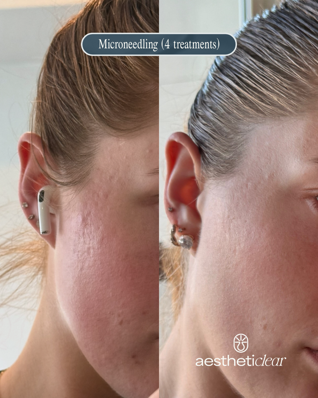 6 months, 4 sessions - 1.PNG