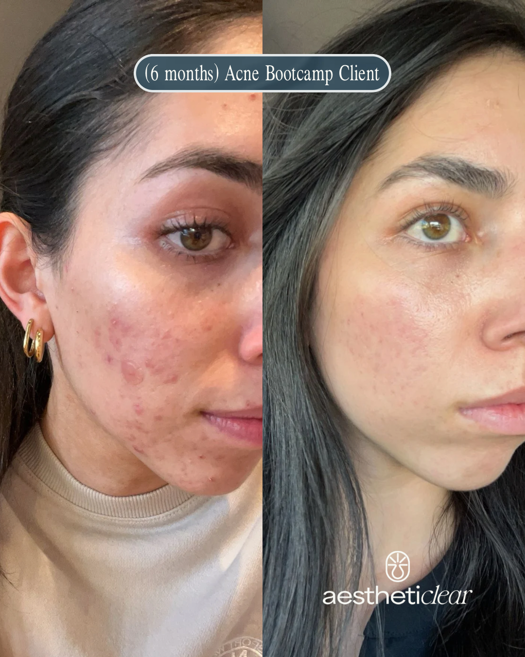 Alyssa B&A - 1.PNG