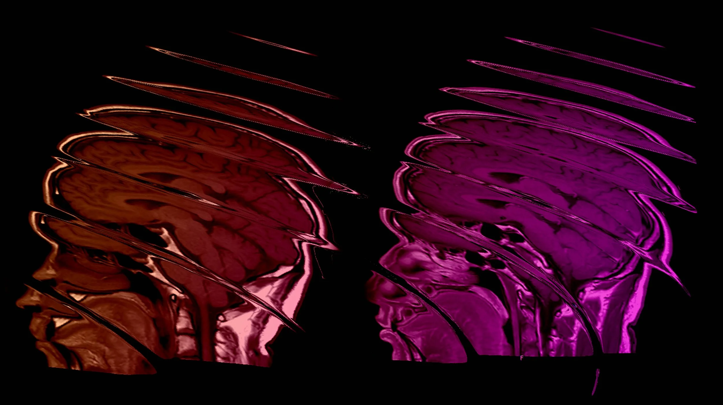 Neural Duet