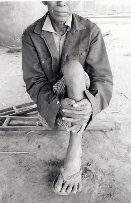 Limb centre, Cambodia