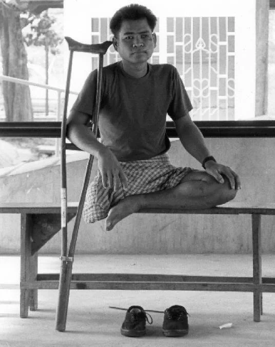 Limb centre, Cambodia