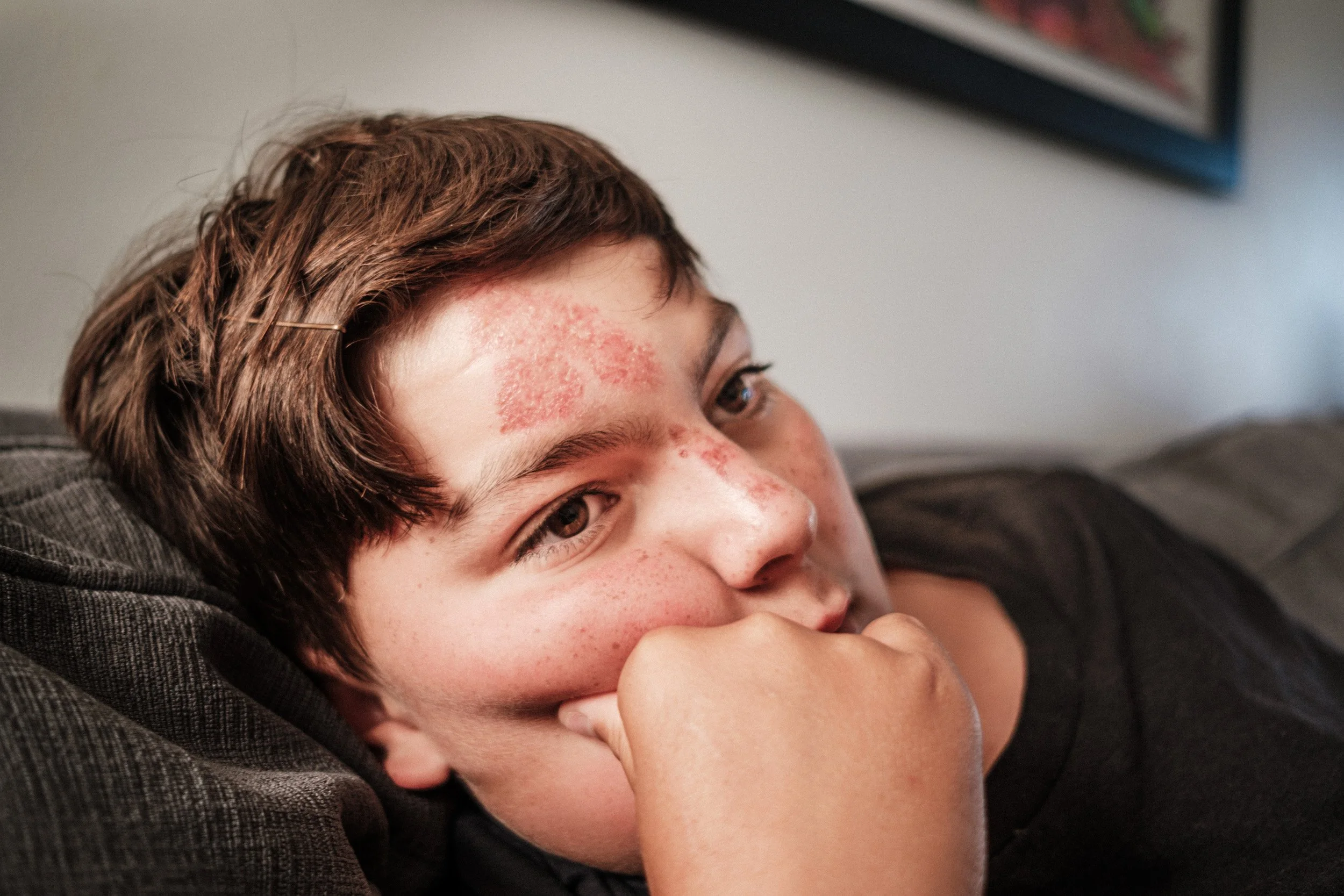 Boy lies on a sofa with his chin resting on his fist, looking at the camera