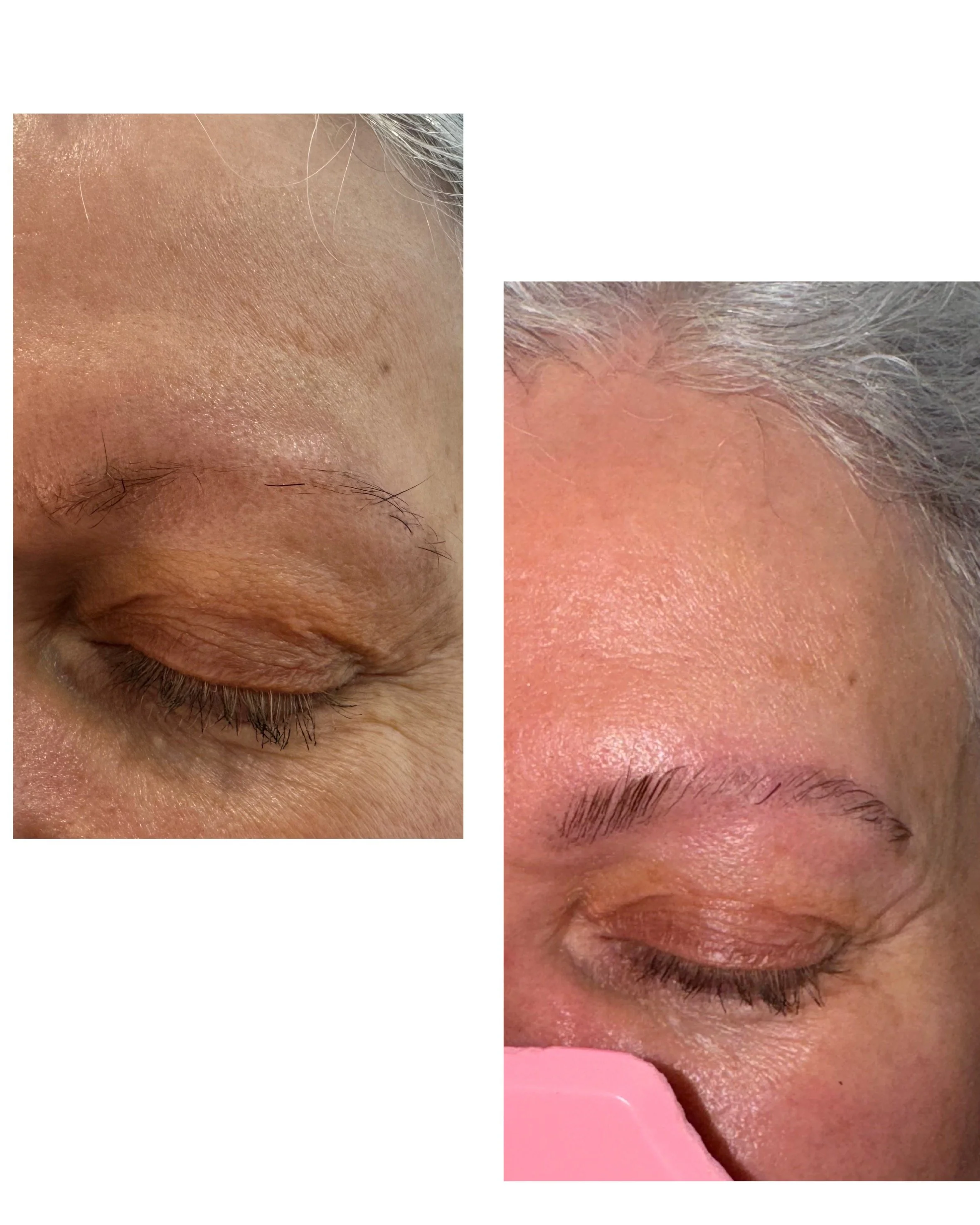 Close-up of a person's forehead and eyes. The person has gray hair, and their skin appears smooth.