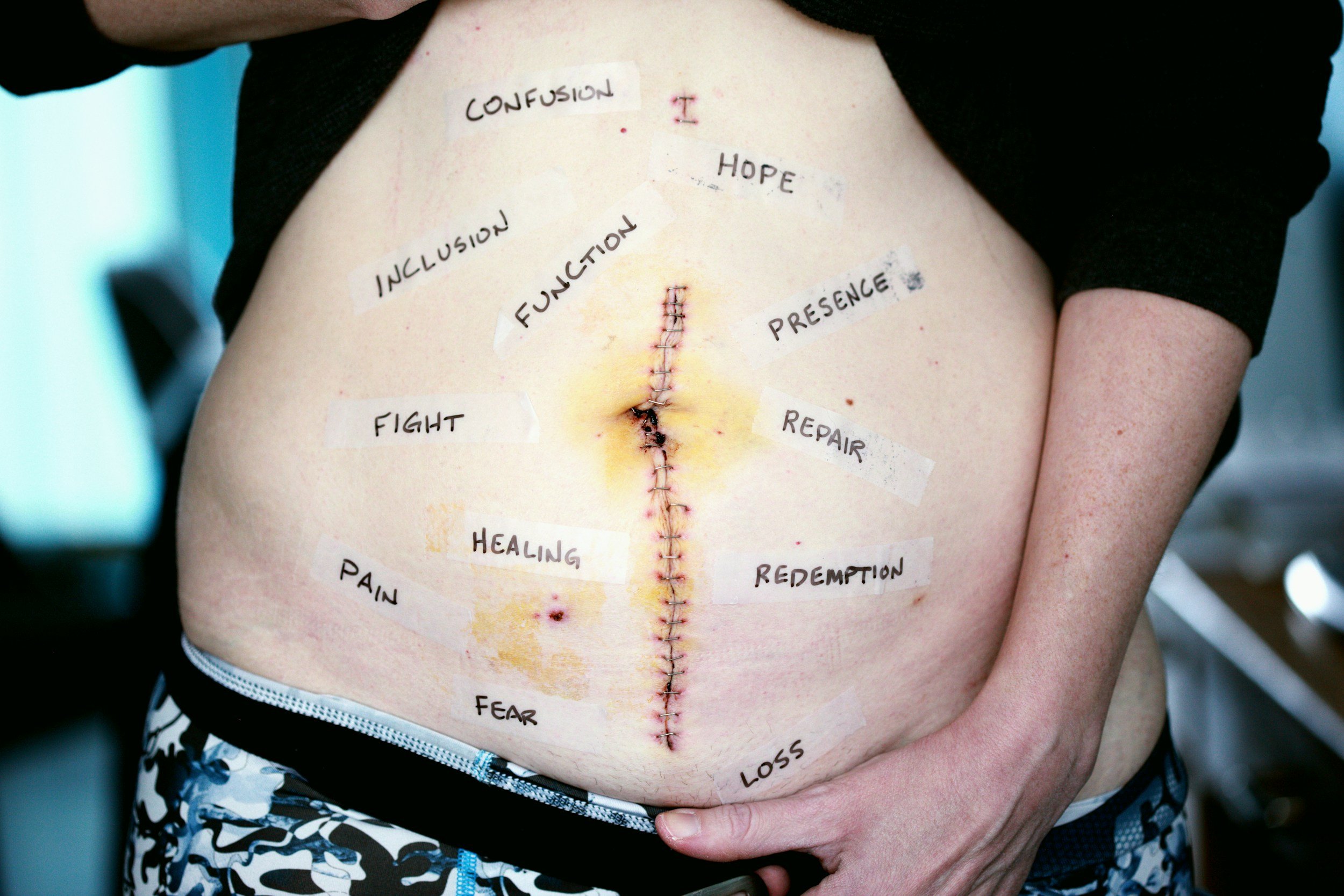 Heal Quicker with scar tissue massage at Unwind - Body & Mind in Hobart, IN