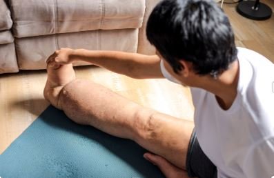 Lymphedema pain relief  at Unwind - Body & Mind in Hobart, IN