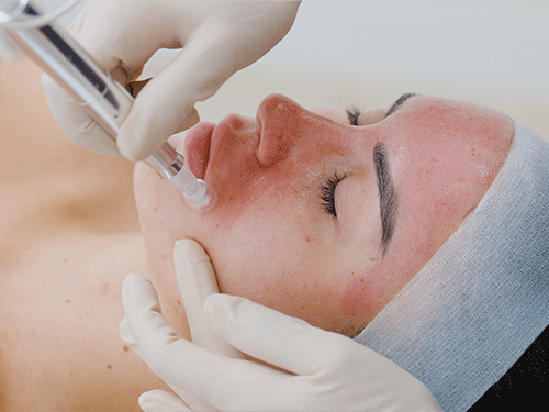 Cosmetic procedure being performed on a woman's face with a syringe and gloved hands in a clinical setting.