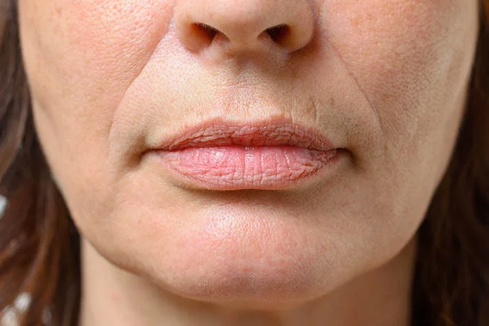 Close-up of a woman's face showing her lips, nose, and chin.