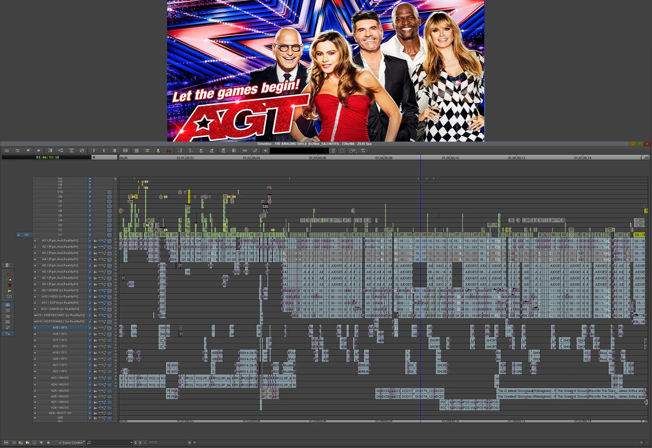 AGT