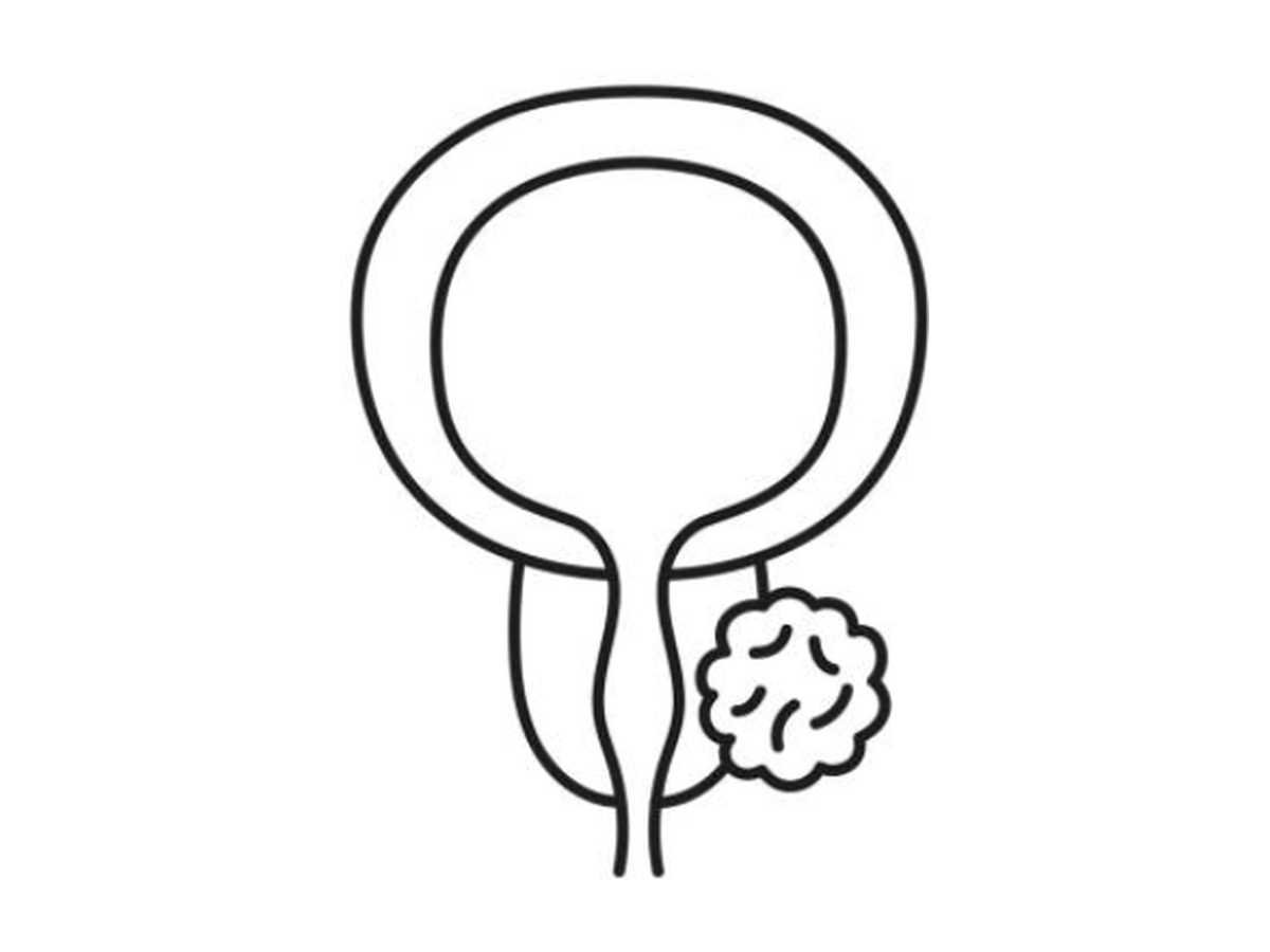 PSA Testing: The Updated 2026 Australian Guidelines