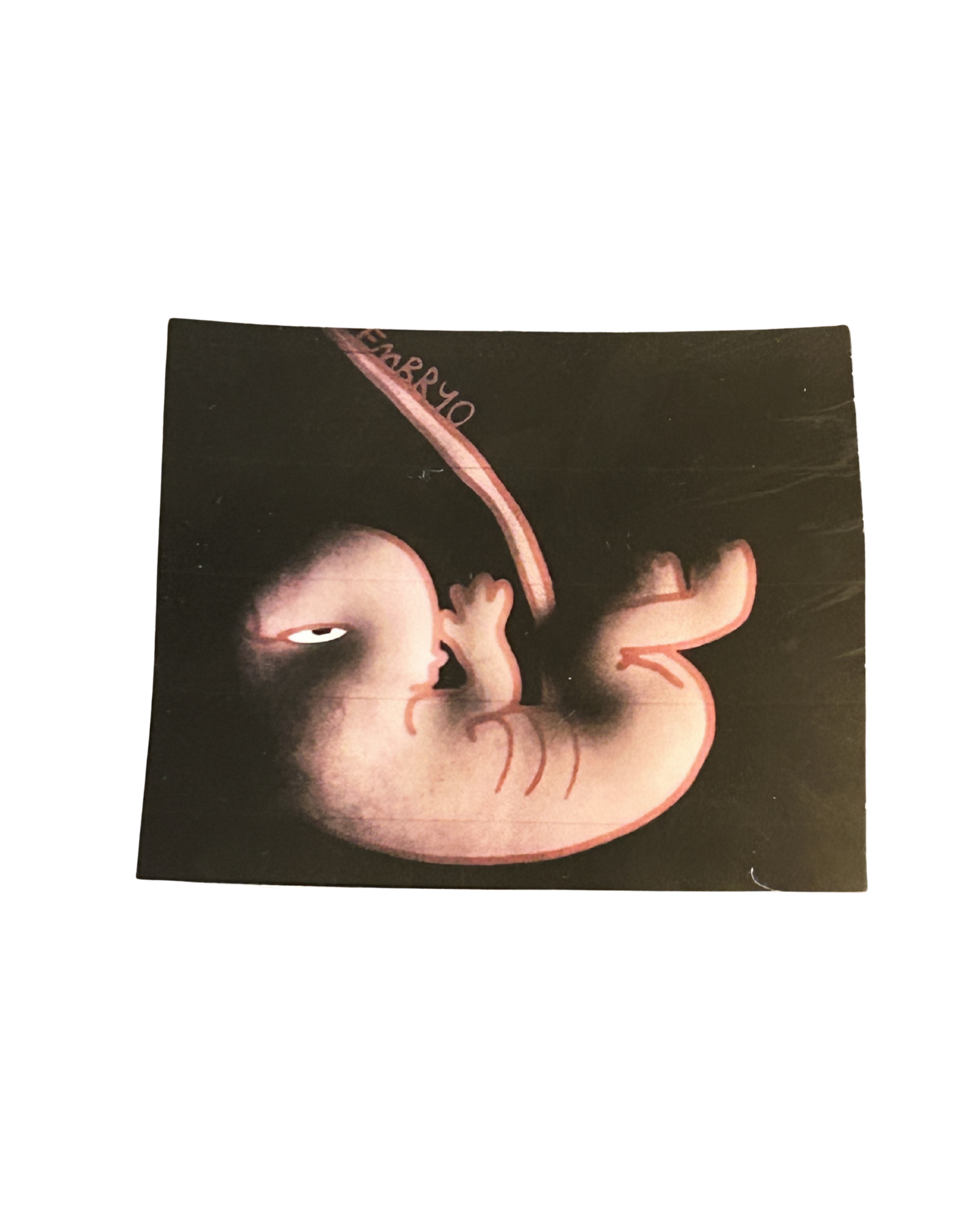 Bingo's Original Art Design "Embryo" Signed Collectible Sticker