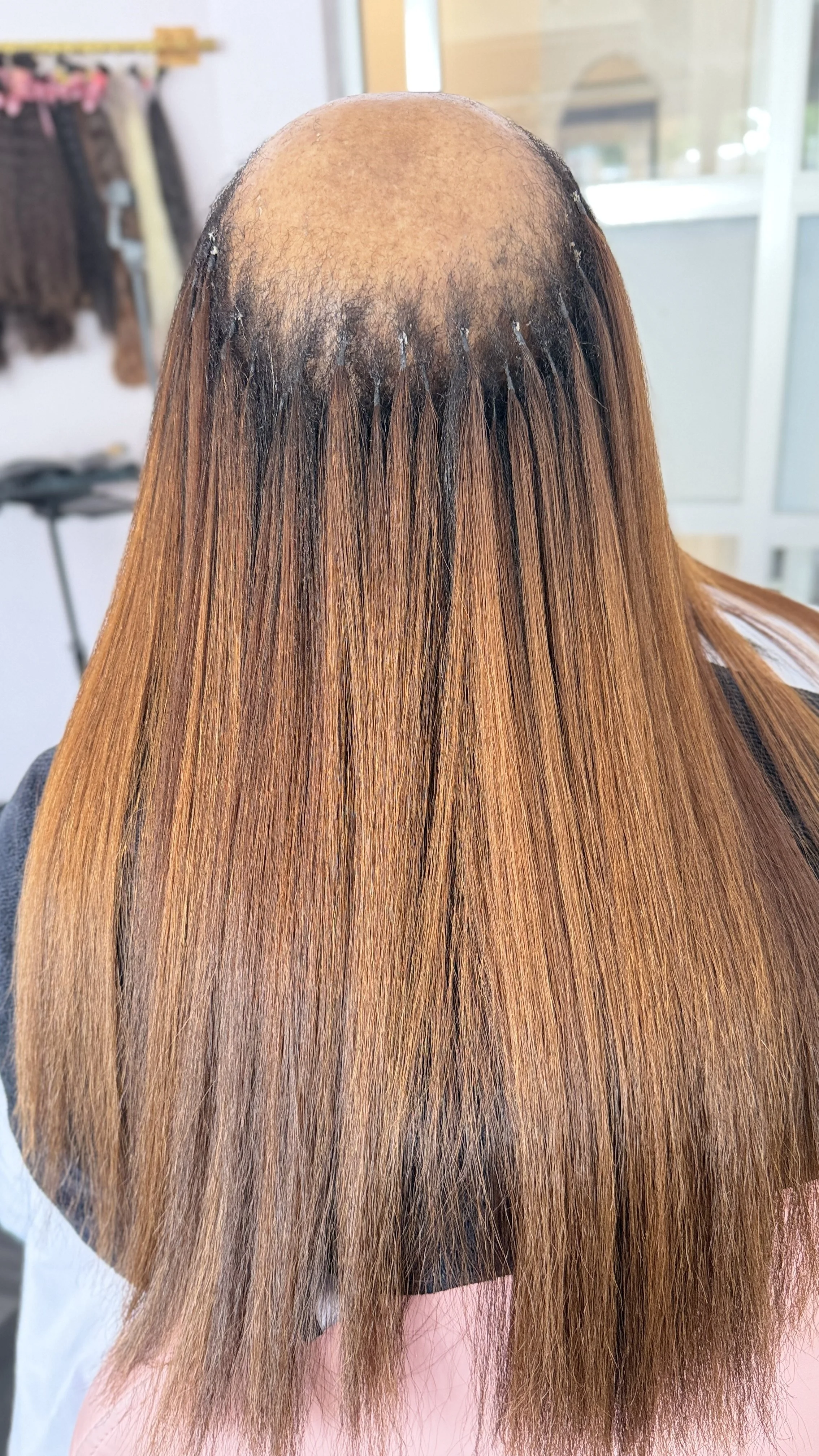 Hair loss solutions for fine hair
