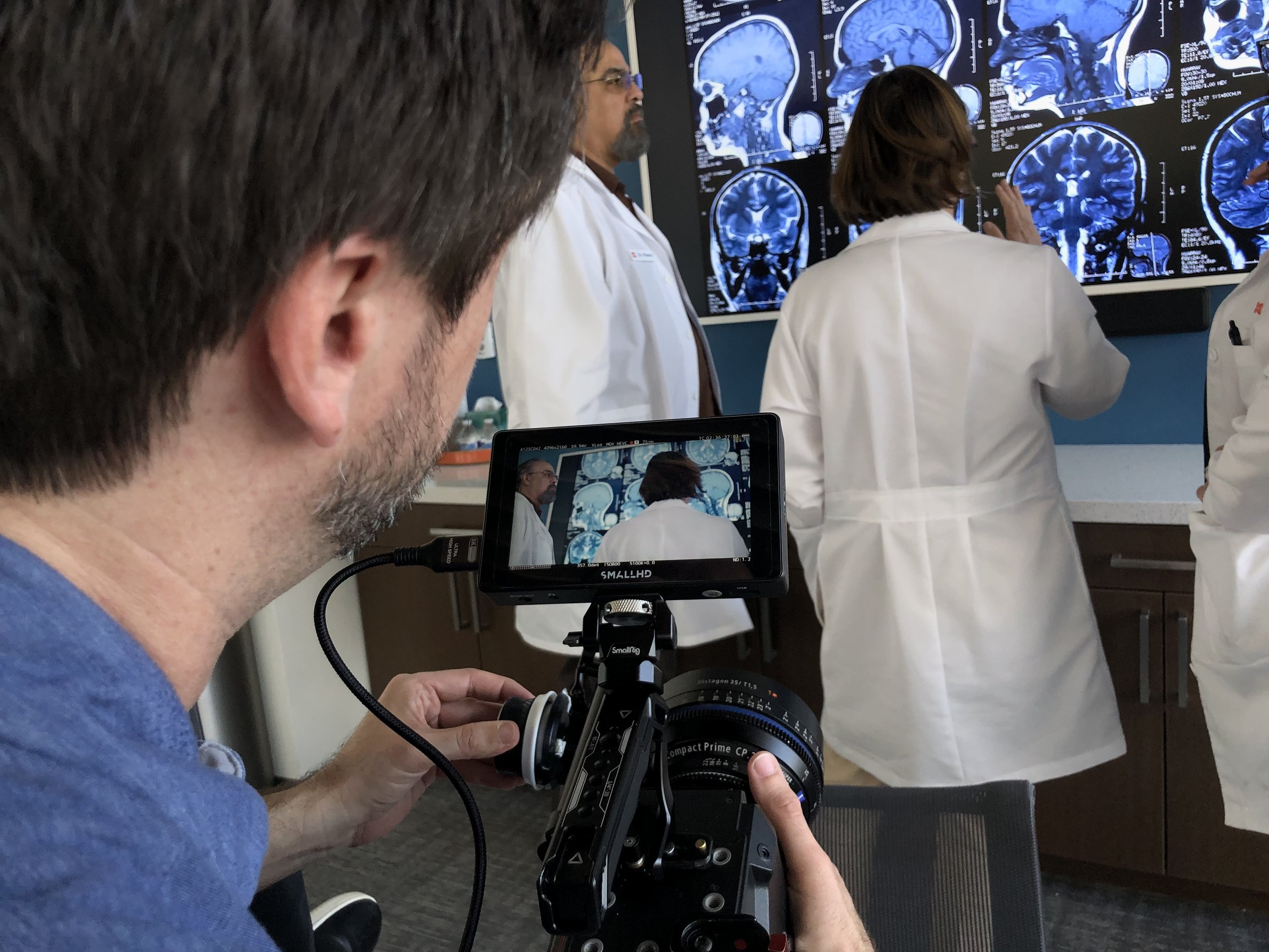 Close-up of a man holding a camera, filming a group of doctors examining brain scans on a large display.