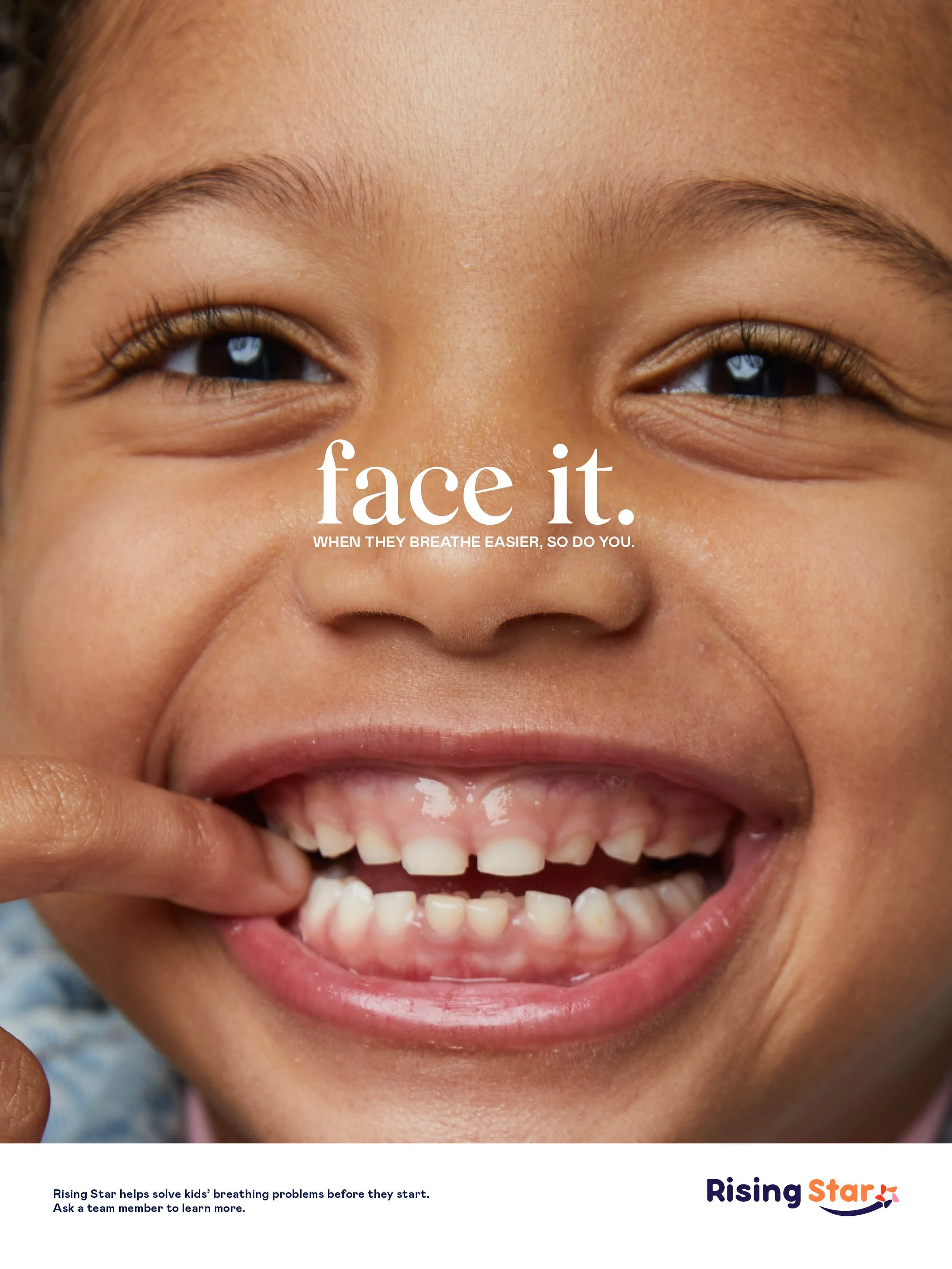 Face It Campaign