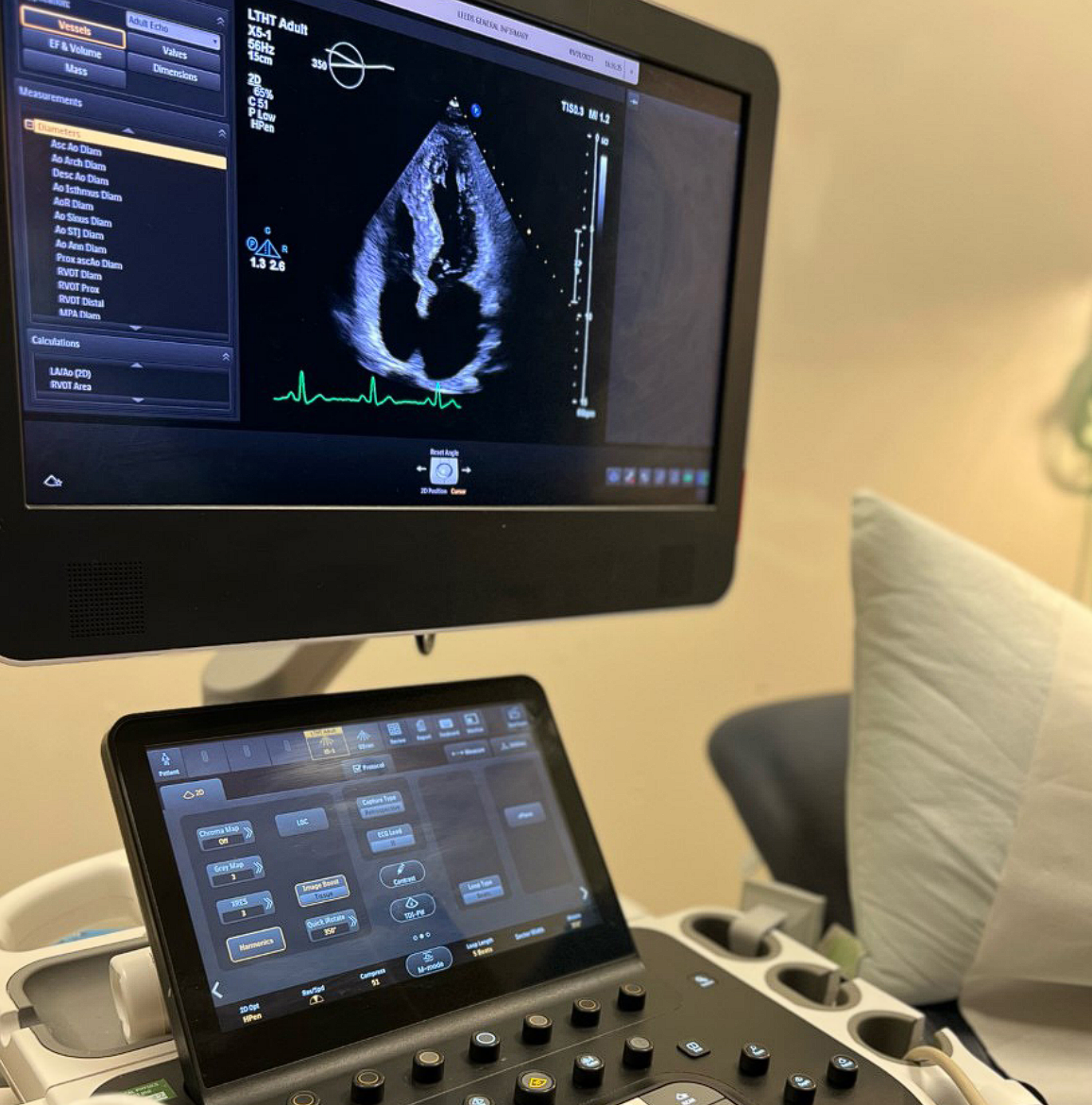 Ecocardiograma