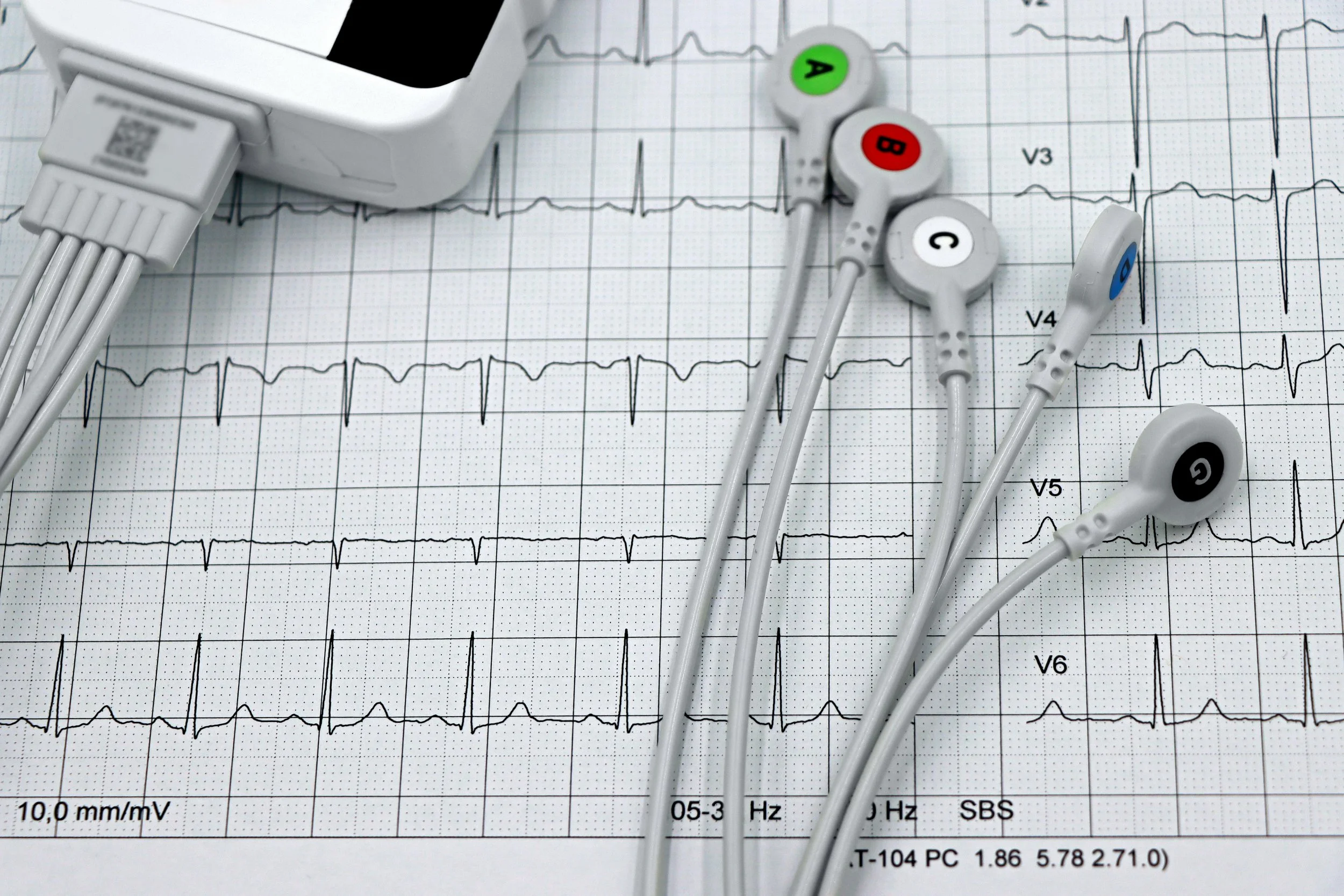 Holter 24 horas