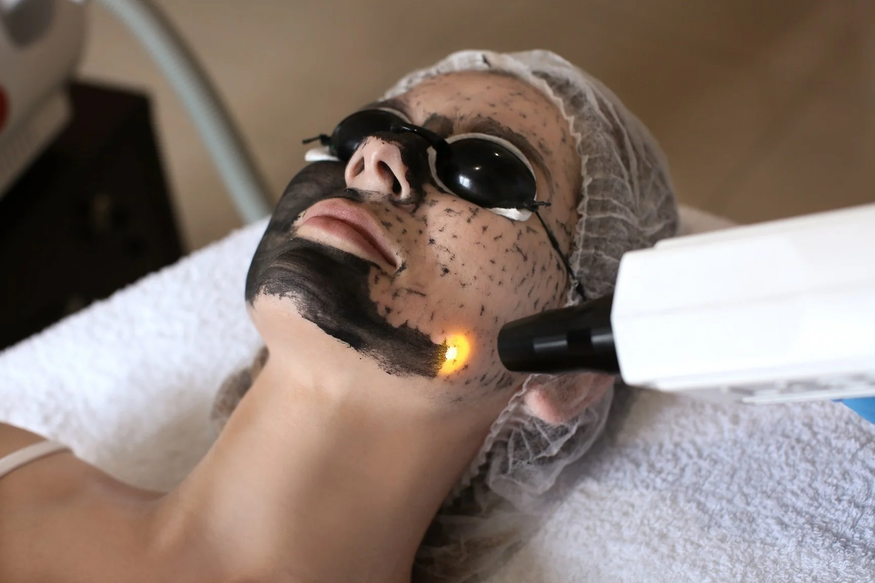 Carbon Facial